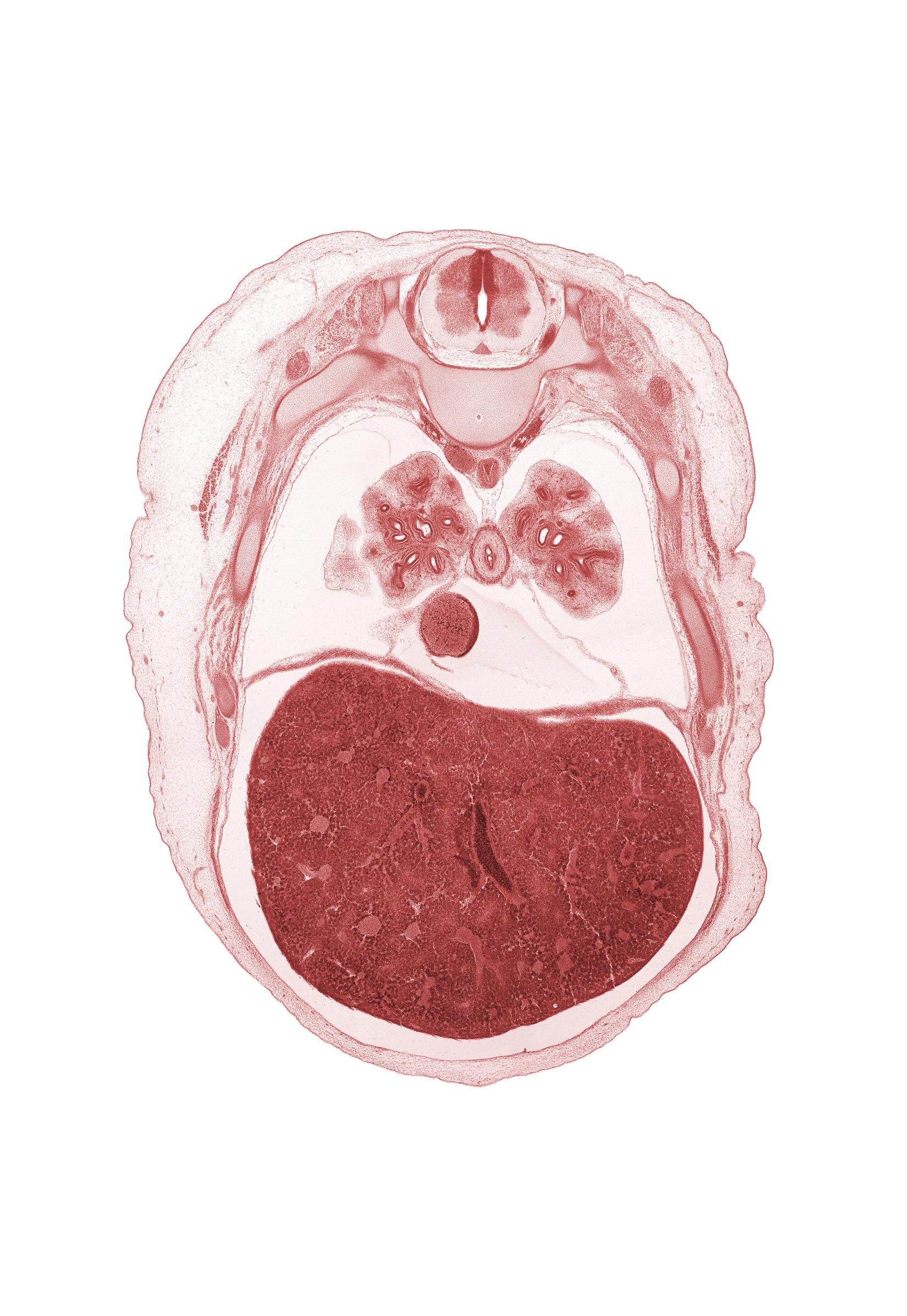 T-6 spinal ganglion, T-6 spinal nerve, azygos vein, caudal edge of middle lobe of right lung, central canal, central tendon of diaphragm, efferent hepatic vein, inferior vena cava, lateral basal segmental bronchus, left lobe of liver, lower lobe of right lung, oblique fissure, pericardial cavity, posterior basal segmental bronchus, rib 7, rib 8, right lobe of liver