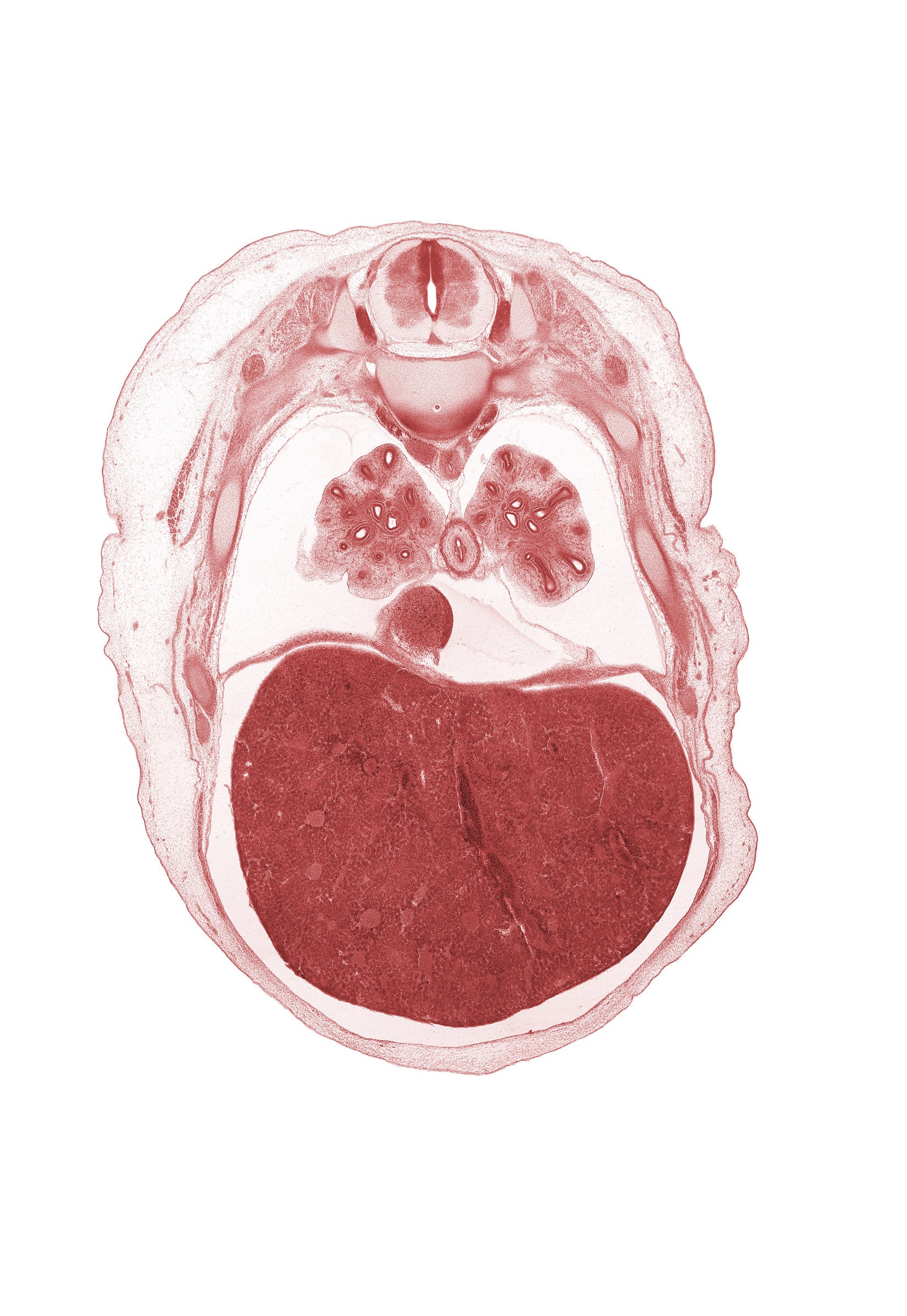 T-6 spinal ganglion, T-6 spinal nerve, dorsal horn of grey matter, intercostal muscle(s), lateral horn of grey matter, left lobe of liver, liver prominence, lower lobe of right lung, muscular part of diaphragm, pericardial cavity, peritoneal cavity, pleural cavity, rib 7, rib 8, right lobe of liver, sympathetic trunk, ventral horn of grey matter