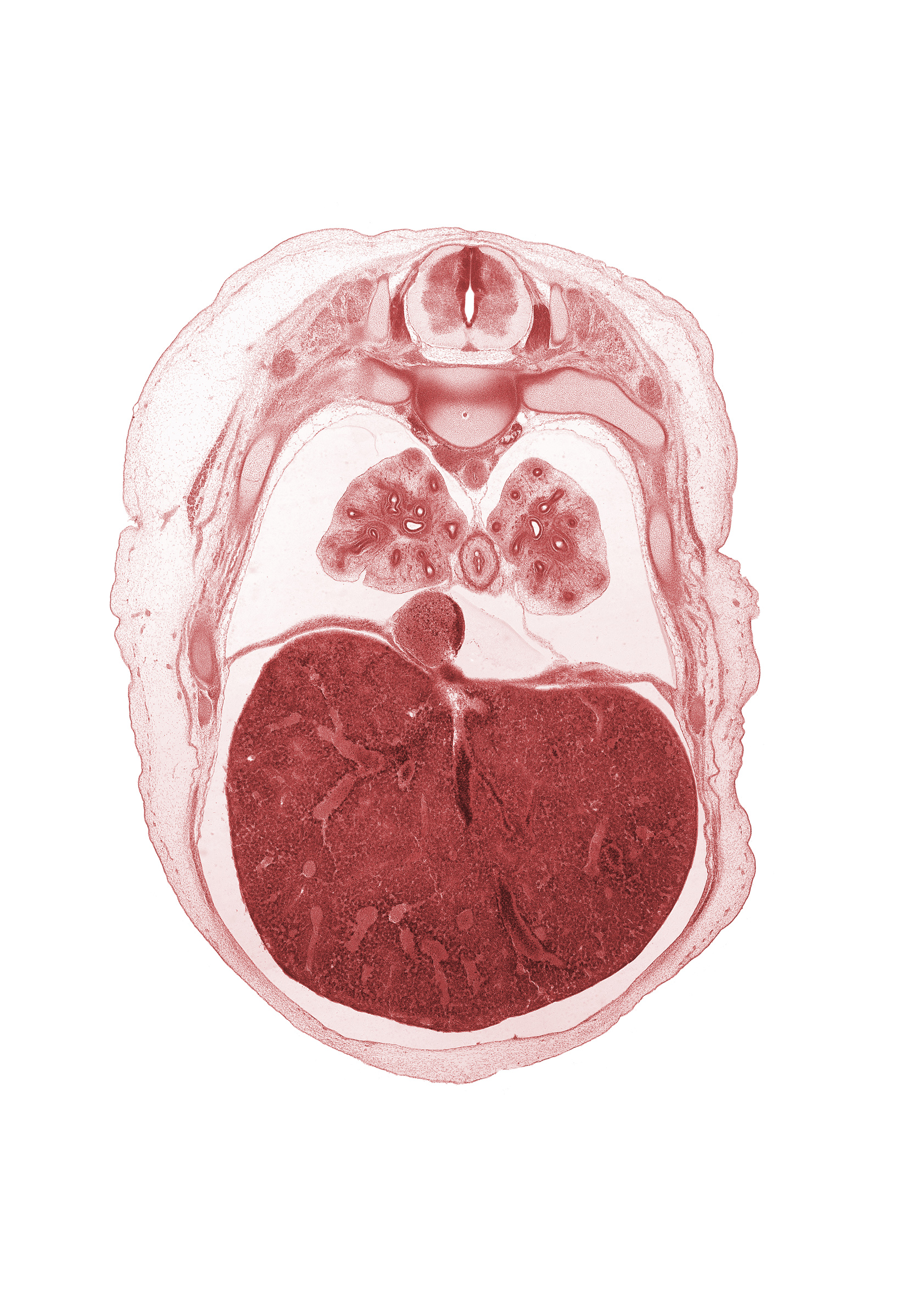 T-6 dorsal root, T-6 spinal ganglion, aorta, dorsal meso-esophagus, head of rib 7