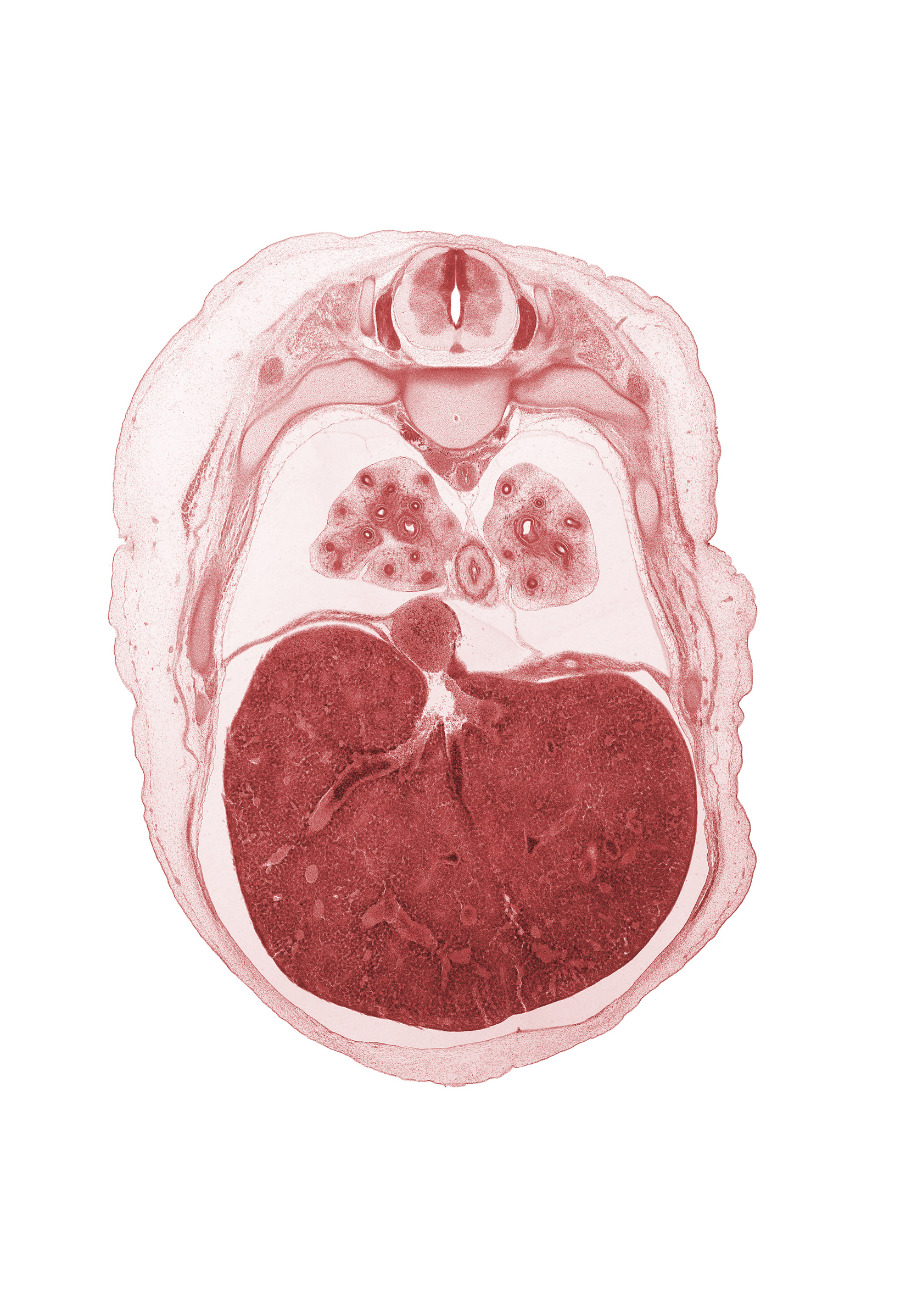 T-6 spinal ganglion, aorta, azygos vein, efferent hepatic vein, iliocostalis muscle, inferior vena cava, junction of hepatic veins and inferior vena cava, left lobe of liver, longissimus muscle, lower lobe of left lung, lower lobe of right lung, muscular layer of esophagus, peritoneal cavity, rib 7, rib 8, spinalis muscle, sympathetic trunk