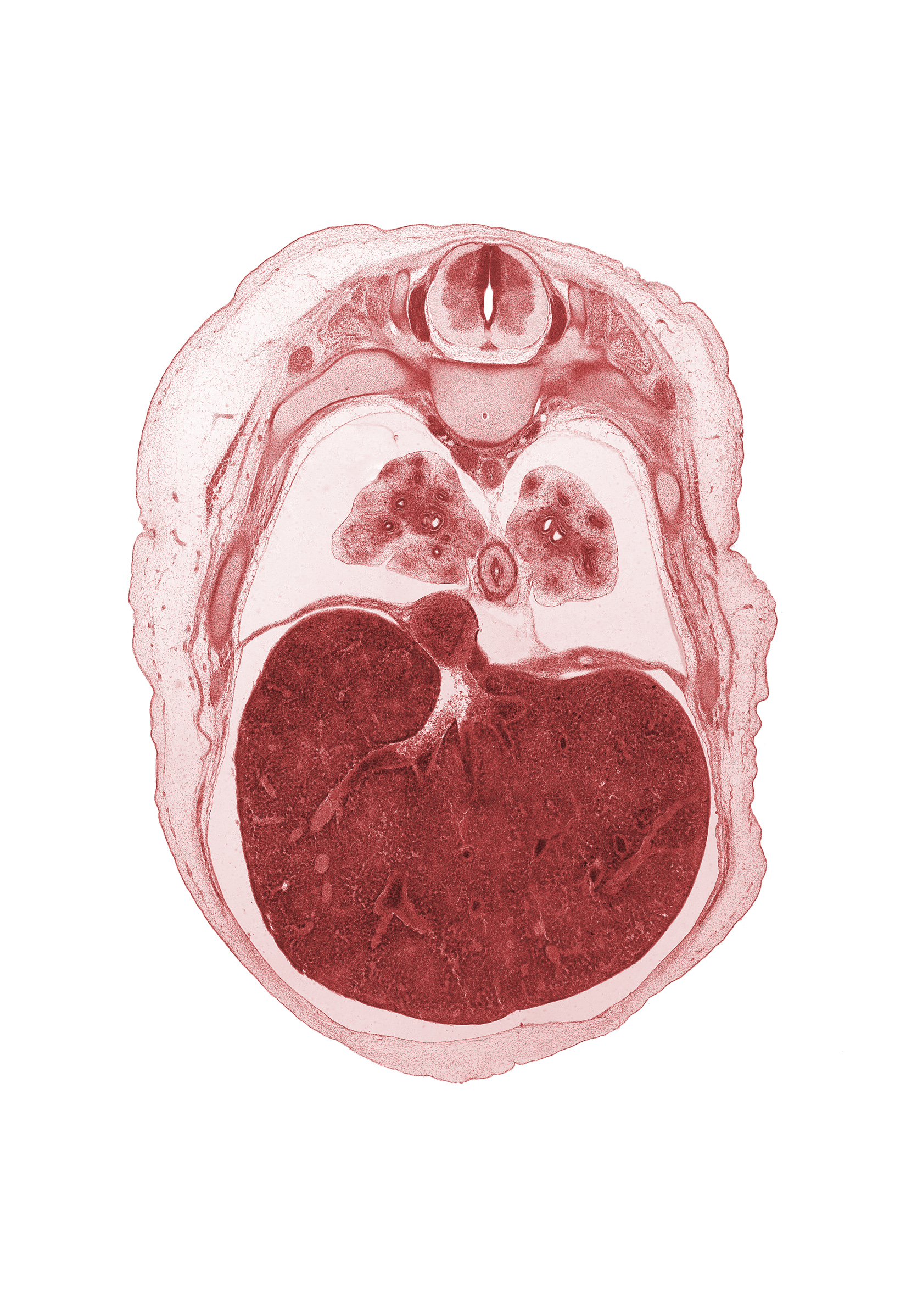 T-6 spinal ganglion, T-7 spinal nerve, aorta, azygos vein, efferent hepatic vein, esophagus, inferior vena cava, latissimus dorsi muscle, left lobe of liver, liver prominence, lower lobe of left lung, lower lobe of right lung, peritoneal cavity, pleural cavity, pulmogenic coat, rectus abdominis muscle, rib 8, right lobe of liver