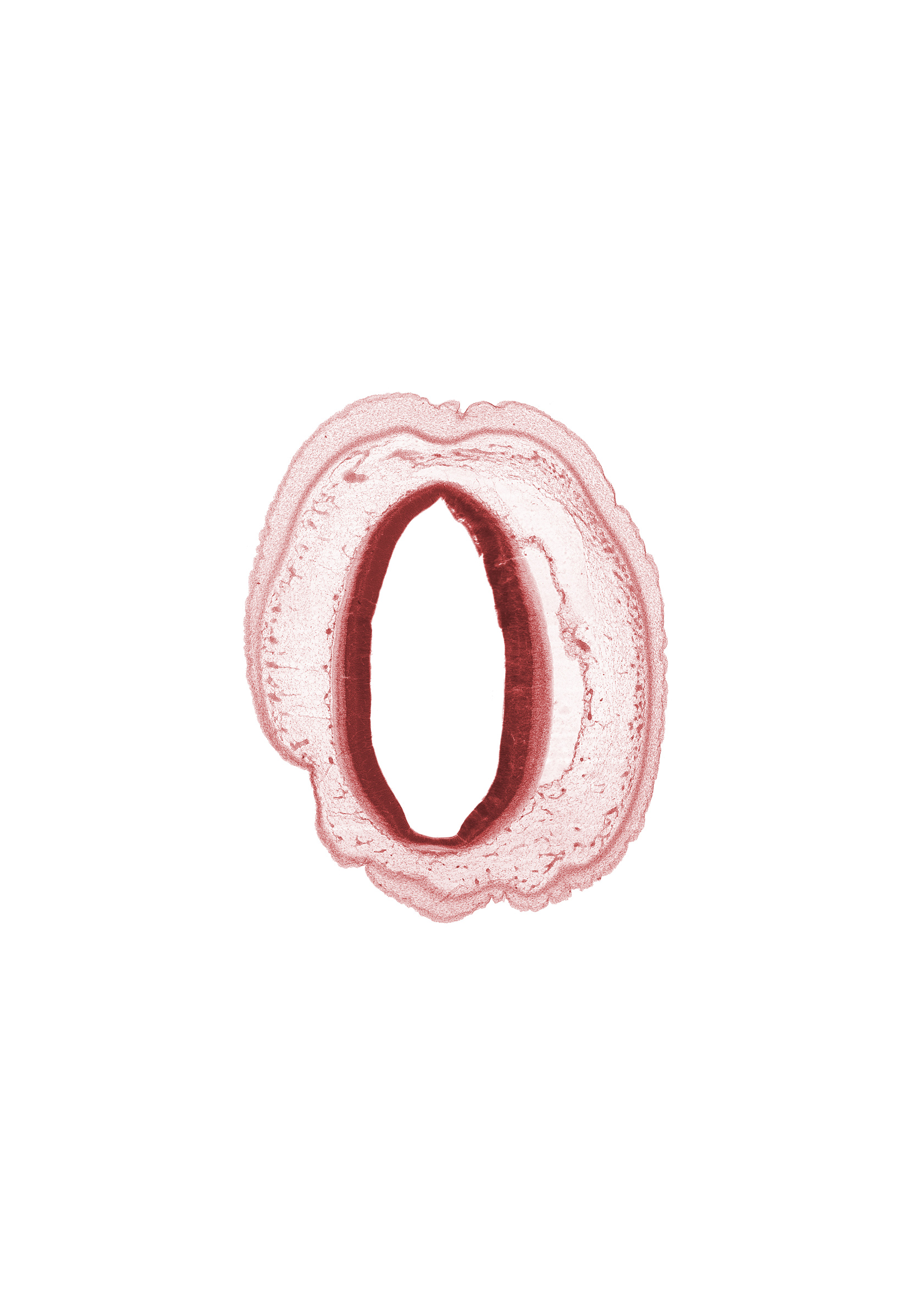 artifact separation(s), cerebral aqueduct (mesocoele), osteogenic layer, roof plate of mesencephalon, subarachnoid space, vascular plexus