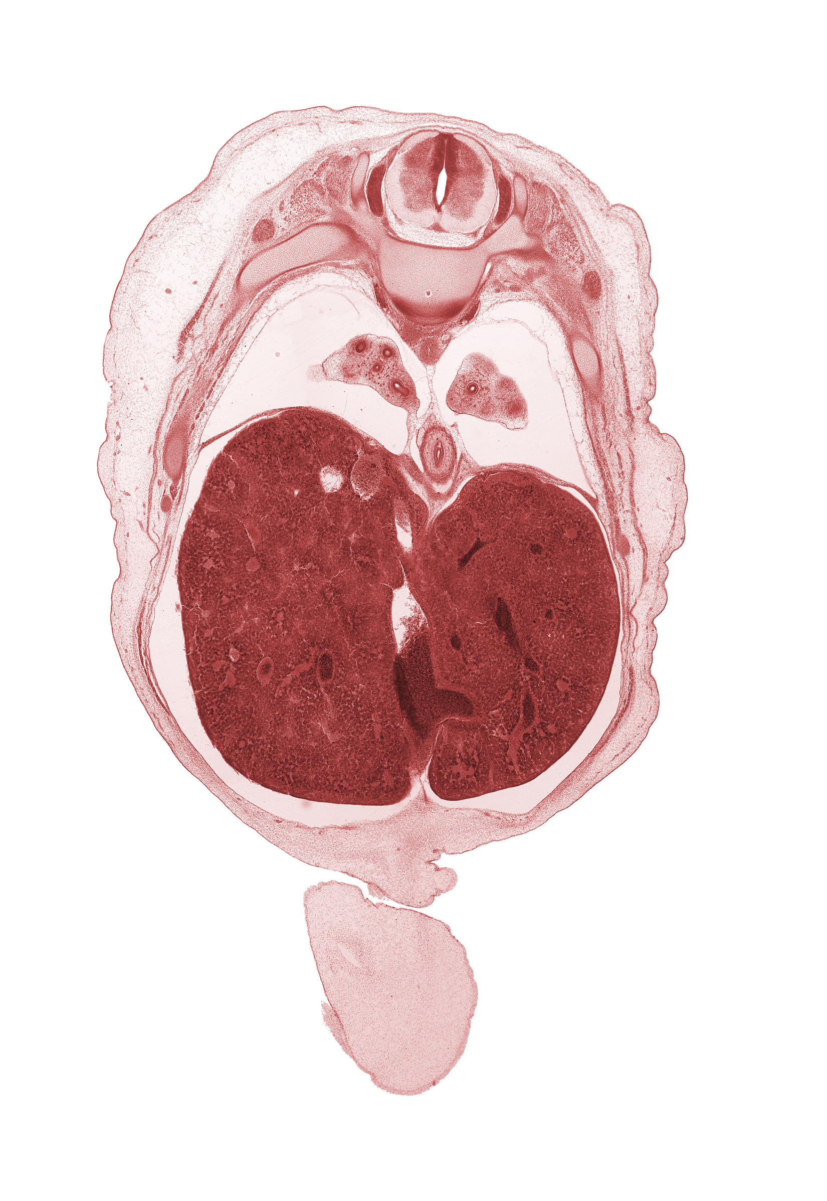 T-8 intercostal nerve, T-8 spinal ganglion, T-8 spinal nerve, afferent hepatic vein, amnion on surface of umbilical cord, azygos vein, diaphragm, ductus venosus, esophagus endoderm, falciform ligament, inferior vena cava (hepatic part), left lobe of liver, lower lobe of left lung, lower lobe of right lung, pleural cavity, rib 9, right lobe of liver, sympathetic trunk