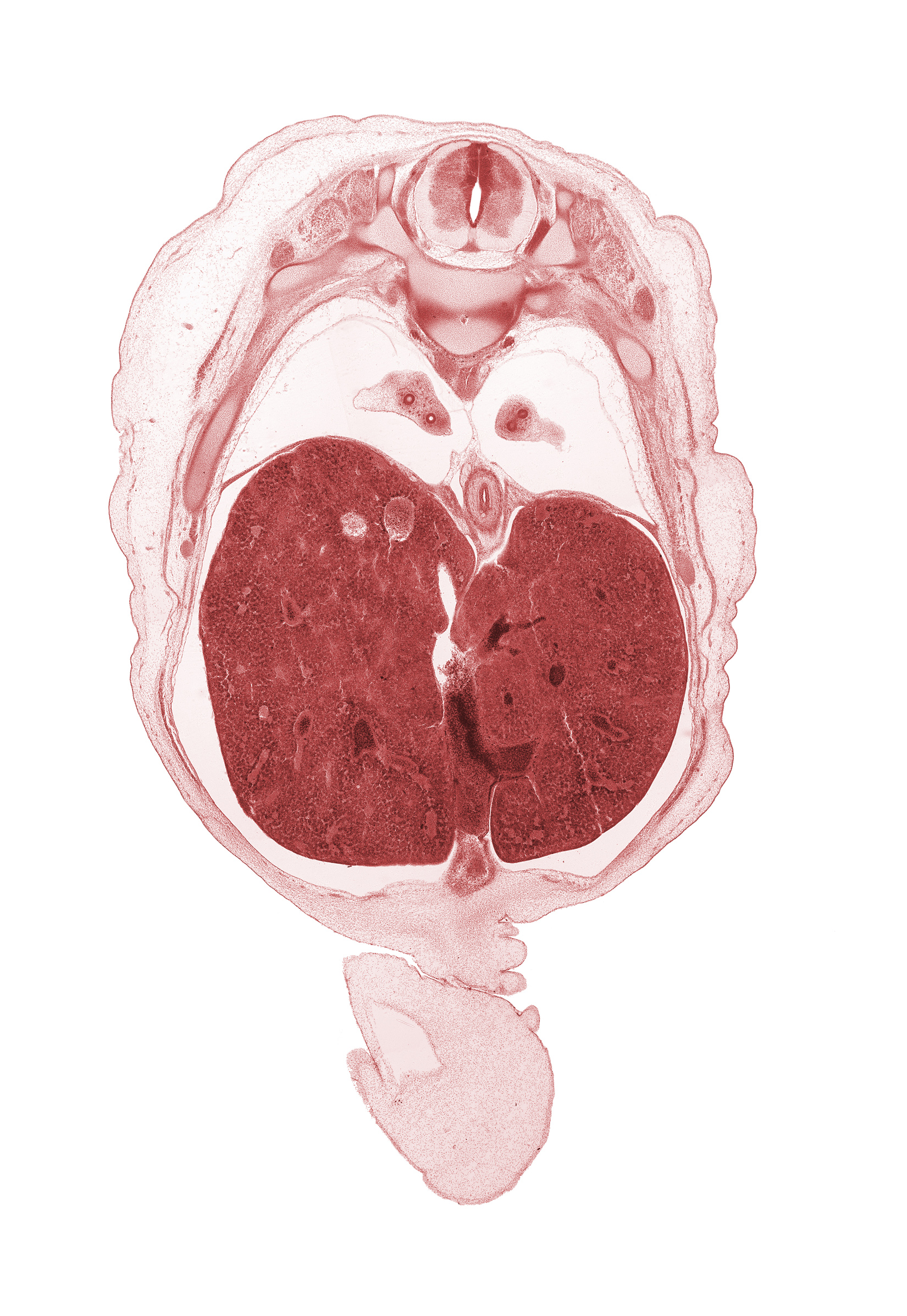 T-9 spinal ganglion, T-9 ventral root, afferent hepatic vein, azygos vein, cephalic edge of umbilical vein, ductus venosus, edge of umbilical coelom, esophageal hiatus, esophagus, grey matter, inferior vena cava (hepatic part), left lobe of liver, lower lobe of left lung, lower lobe of right lung, neural arch, posterior intercostal artery, rib 9, right lobe of liver, white matter