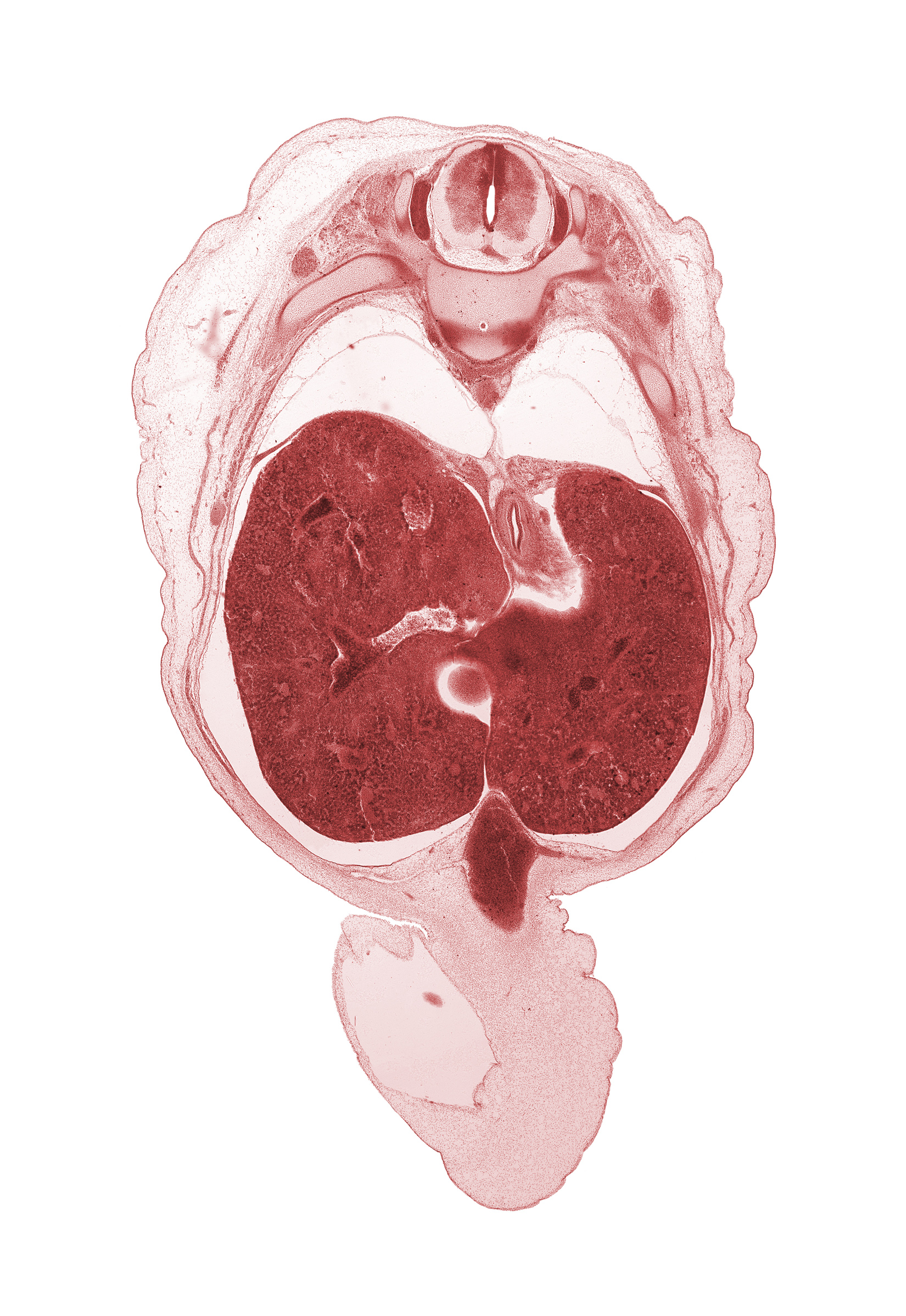 T-9 spinal ganglion, T-9 spinal nerve, afferent hepatic vein, aorta, edge of herniated midgut, edge of pyloric antrum of stomach, esophageal hiatus in diaphragm, esophagus, greater splanchnic nerve, hepatic portal vein, inferior vena cava (hepatic part), left lobe of liver, peritoneal cavity, pleural cavity, rib 10, sympathetic trunk, umbilical coelom, umbilical cord, umbilical vein