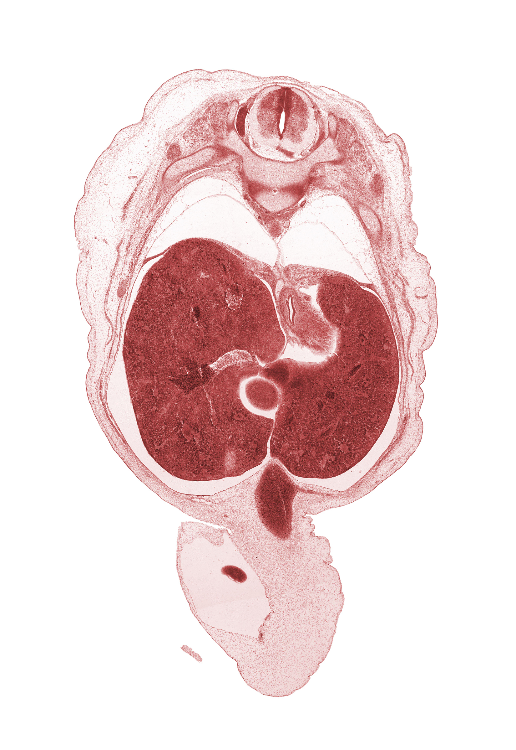 T-10 spinal ganglion, T-9 spinal nerve, afferent hepatic vein, caudate lobe of liver, cephalic edge of gall bladder, edge of herniated midgut, grey matter, hepatic portal vein, inferior vena cava (hepatic part), junction of esophagus and stomach, left lobe of liver, lesser sac (omental bursa), notochord, pleural recess, rib 10, right lobe of liver, umbilical cord, umbilical vein, wall of pyloric antrum of stomach, white matter