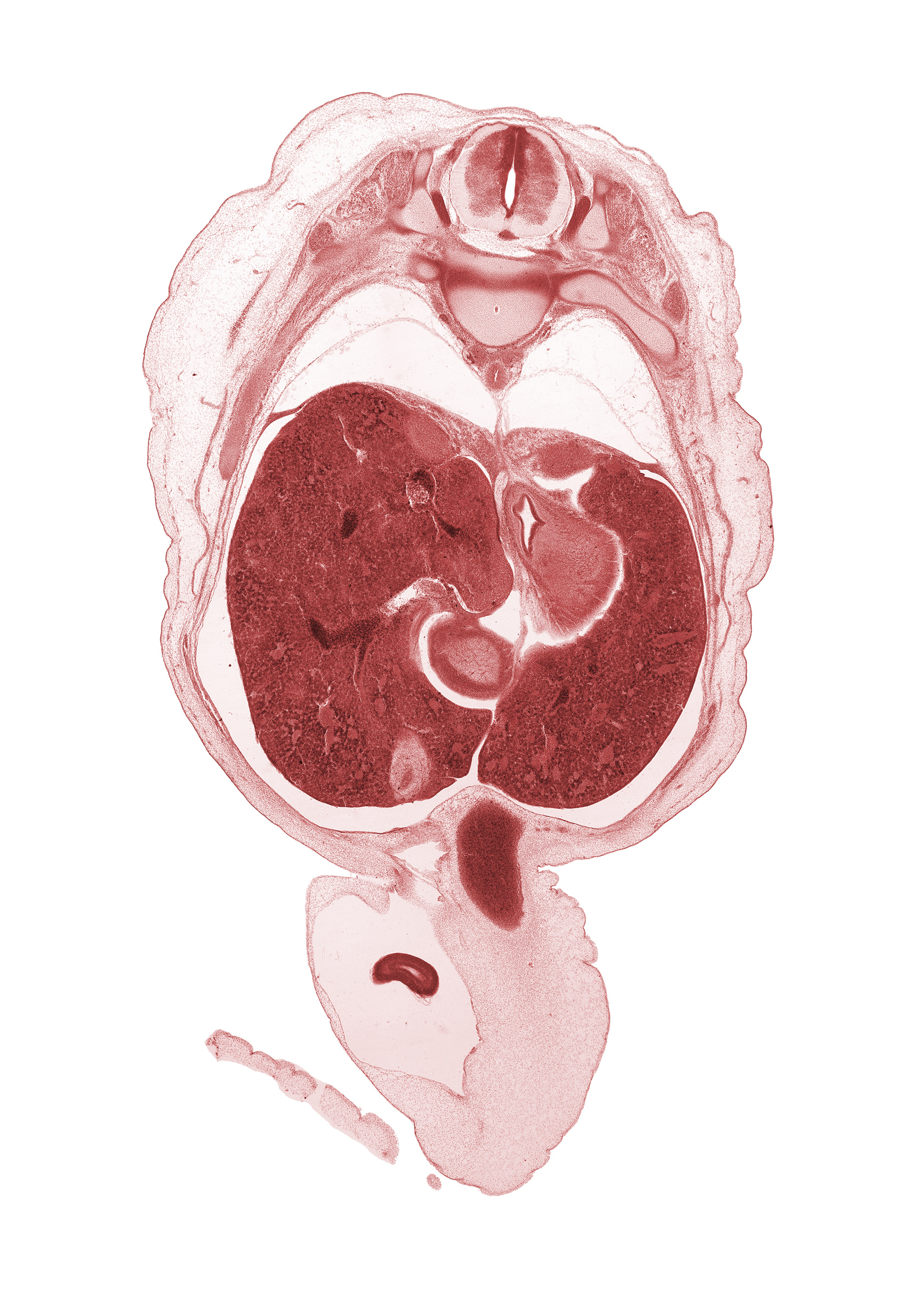 T-10 spinal ganglion, aorta, azygos vein, cardiac portion of stomach, caudate lobe of liver, cephalic edge of suprarenal gland, cephalic edge of suprarenal gland cortex, cystic duct, distal limb of herniated midgut, dorsal horn of grey matter, gall bladder, head of rib 10, hepatic portal vein, inferior hemi-azygos vein, lateral horn of grey matter, left lobe of liver, muscularis of body of stomach, muscularis of pyloric antrum of stomach, right lobe of liver, umbilical vein, ventral horn of grey matter