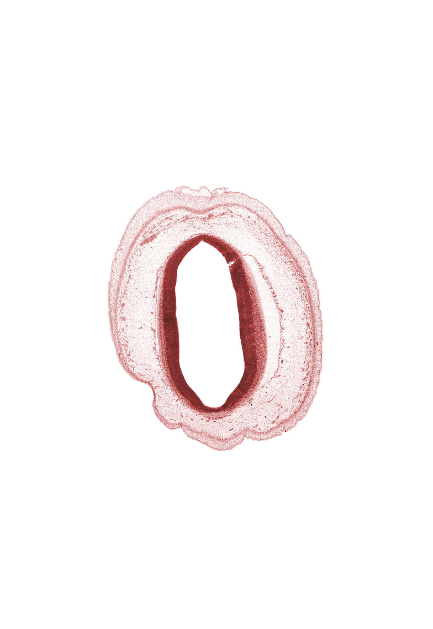 artifact fracture(s), artifact separation(s), cerebral aqueduct (mesocoele), intermediate zone, marginal zone, ventricular zone