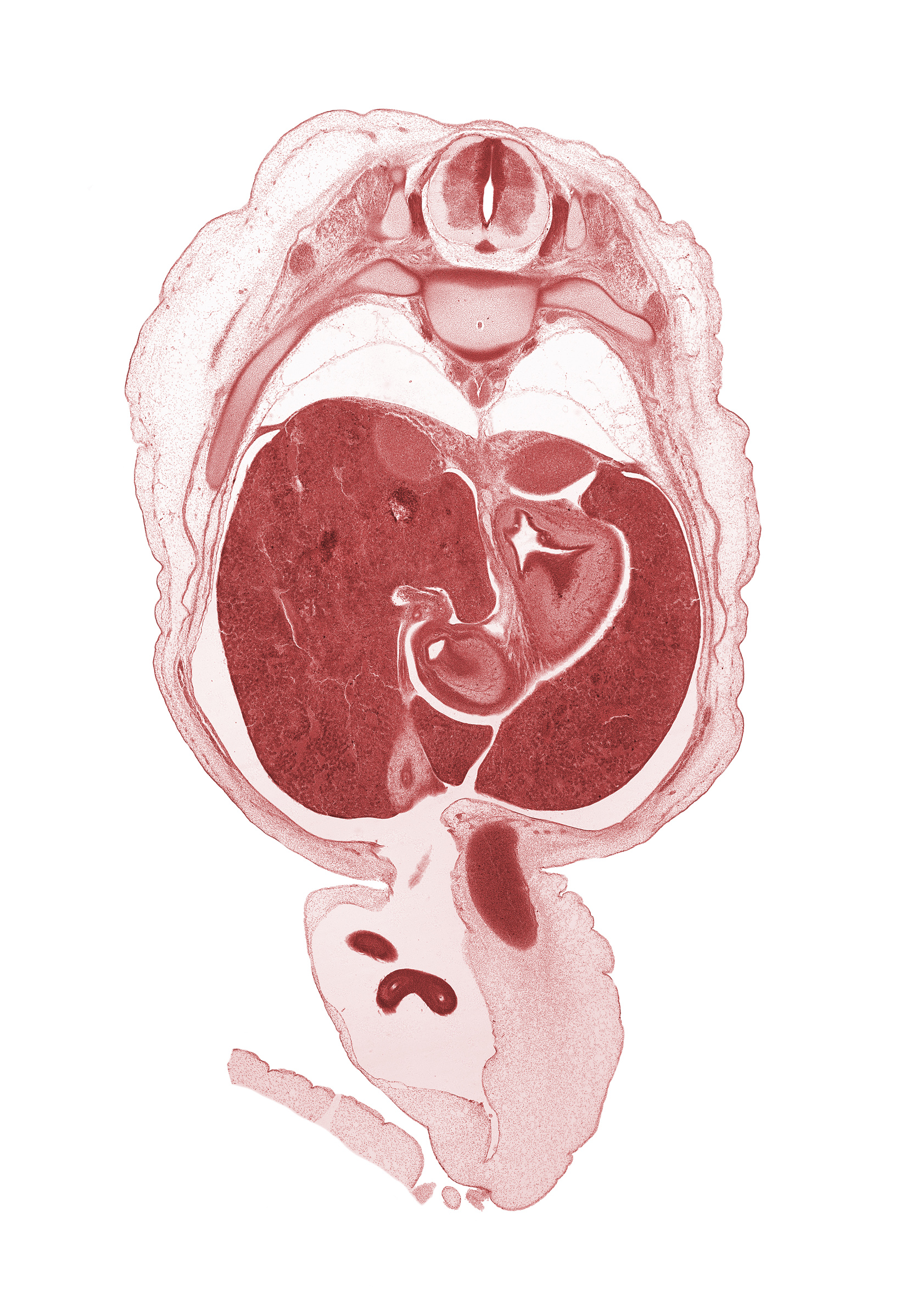 T-10 spinal ganglion, T-10 spinal nerve, aorta, central canal, centrum of T-10 vertebra, common hepatic duct, cystic duct, distal limb of herniated midgut, endoderm lining, endoderm lining of stomach (mucosa), gall bladder, head of rib 10, hepatic artery, hepatic portal vein, intermediate zone, lesser curvature of stomach, marginal zone, muscularis of pyloric antrum of stomach, peritoneal cavity, pleural cavity, proximal limb of herniated midgut, splanchnic mesoderm, superior part of duodenum (first part), suprarenal gland cortex, umbilical coelom, umbilical vein, ventricular zone