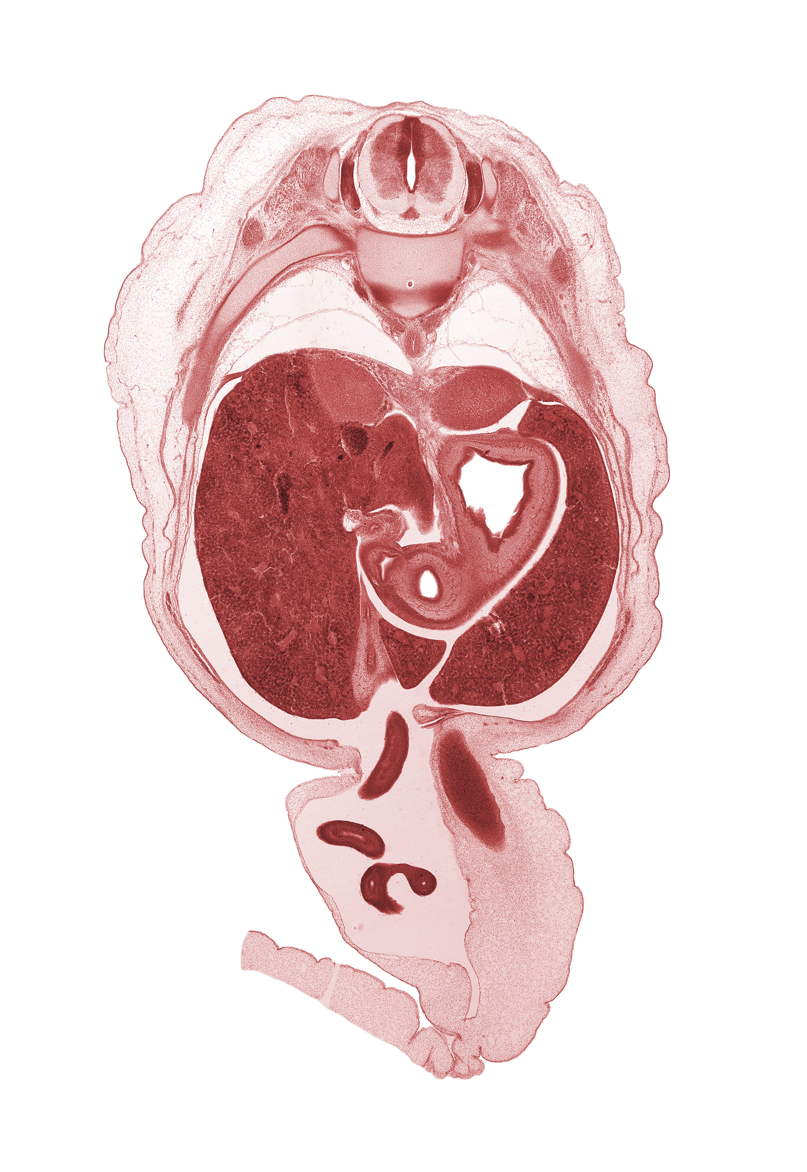 T-10 / T-11 intervertebral disc, T-10 intercostal nerve, T-10 spinal ganglion, T-10 spinal nerve, amnion on surface of umbilical cord, aorta, caudal edge of gall bladder, cephalic edge of testis, cystic duct, diaphragm, distal limb of herniated midgut, fundus of stomach, hepatic artery, hepatic portal vein, iliocostalis muscle, left lobe of liver, lesser sac (omental bursa), longissimus muscle, neural arch, proximal limb of herniated midgut, pyloric antrum of stomach, pyloric sphincter, quadrate lobe of liver, right lobe of liver, spinalis muscle, superior part of duodenum (first part), suprarenal gland cortex, umbilical vein