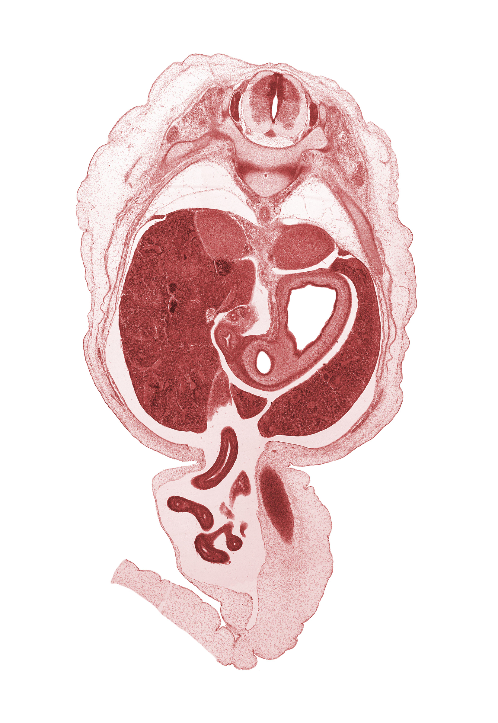 T-10 / T-11 intervertebral disc, T-10 spinal ganglion, T-10 ventral root(s), aorta, distal limb of herniated midgut, junction of common hepatic and cystic ducts, lesser curvature of stomach, mesocolon, notochord, proximal limb of herniated midgut, pyloric antrum of stomach, pyloric sphincter, rib 11, superior part of duodenum (first part), suprarenal gland cortex, testis, umbilical coelom, umbilical vein