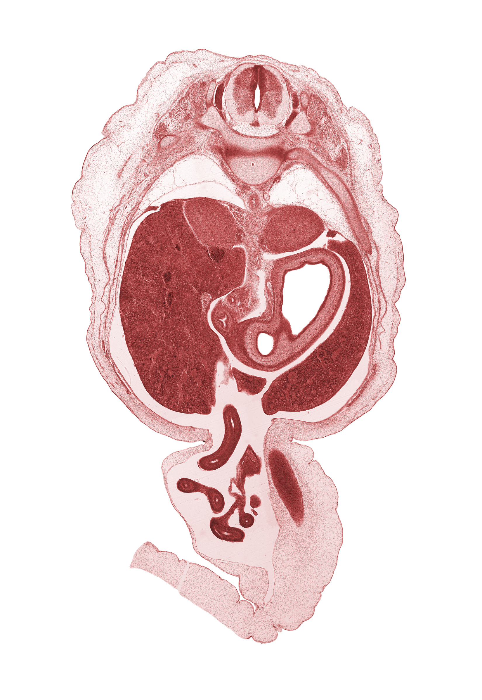 T-10 / T-11 intervertebral disc, T-10 spinal nerve, T-11 spinal ganglion, aorta, bile duct, distal limb of herniated midgut, inferior vena cava (hepatic part), jejunum, lumen of body of stomach, lumen of pyloric antrum of stomach, mucoid connective tissue, proximal limb of herniated midgut, rib 11, right lobe of liver, superior part of duodenum, suprarenal gland cortex, testis, umbilical cord, umbilical vein