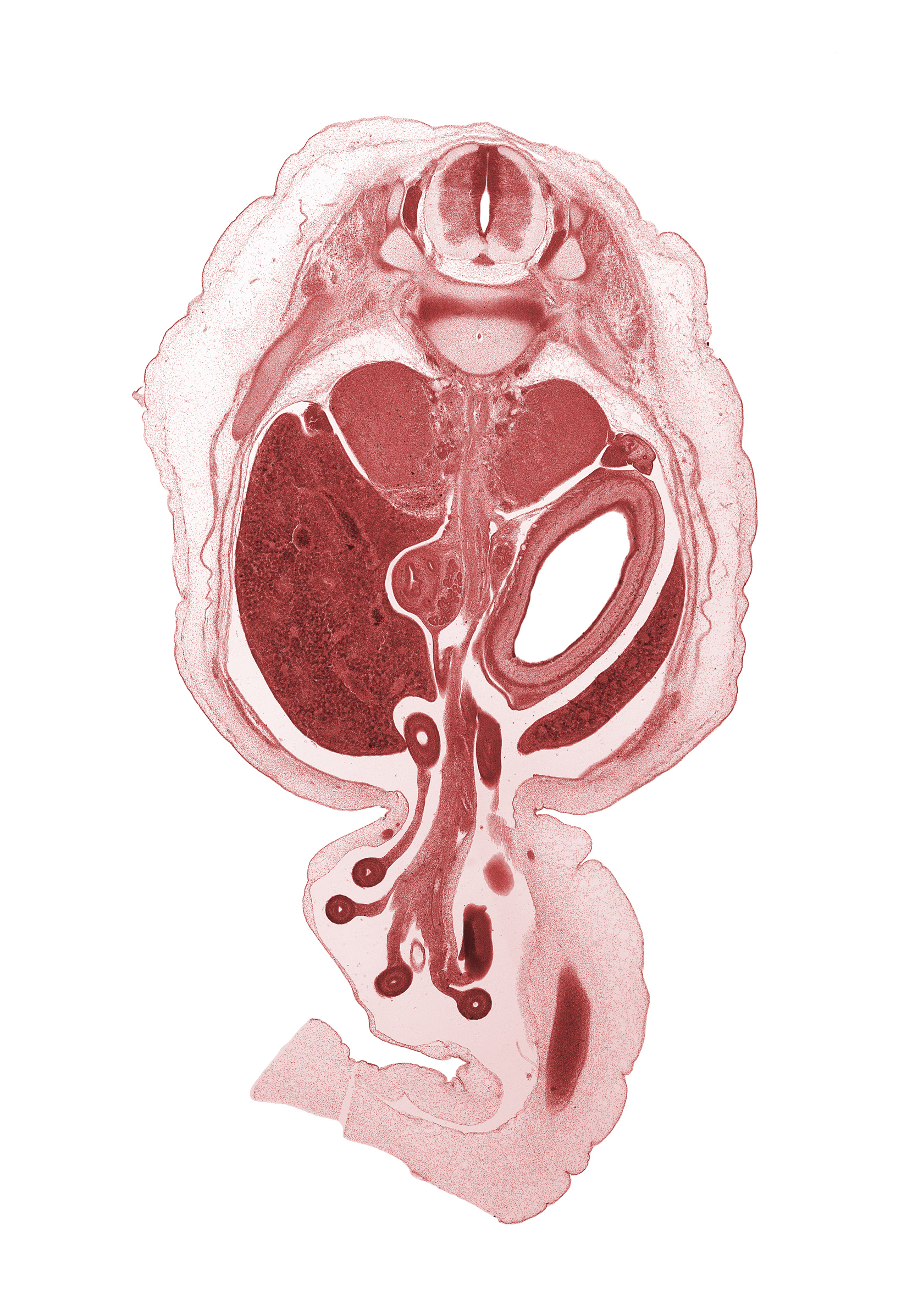 T-11 / T-12 intervertebral disc, T-11 spinal nerve, T-12 spinal ganglion, allantois, aorta, celiac ganglion, centrum of T-12 vertebra, descending part of duodenum (second part), distal limb of herniated midgut, greater curvature of stomach, head of ventral pancreas, hindgut (colon), jejunum, proximal limb of herniated midgut, rectus abdominis muscle, spleen, testis, umbilical vein