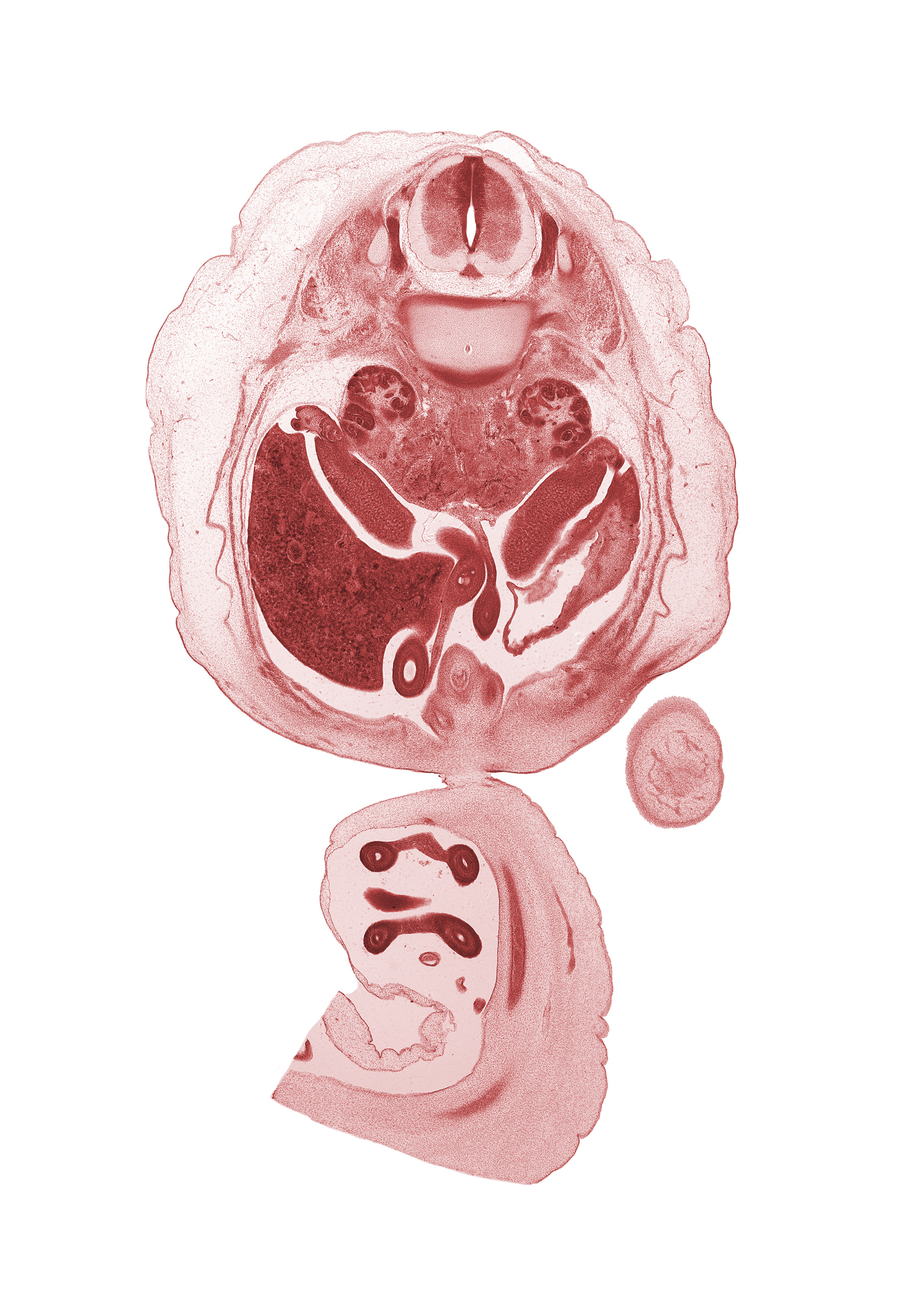 L-1 spinal ganglion, T-12 spinal ganglion, aorta, apex of urinary bladder, centrum of L-1 vertebra, duodenum, hindgut (colon), jejunum, kidney (metanephros), left umbilical artery, lesser sac (omental bursa), mesocolon, omphalomesenteric artery, proximal limb of herniated midgut, right lobe of liver, right umbilical artery, spleen, tail of dorsal pancreas, testis, vas deferens (mesonephric duct)