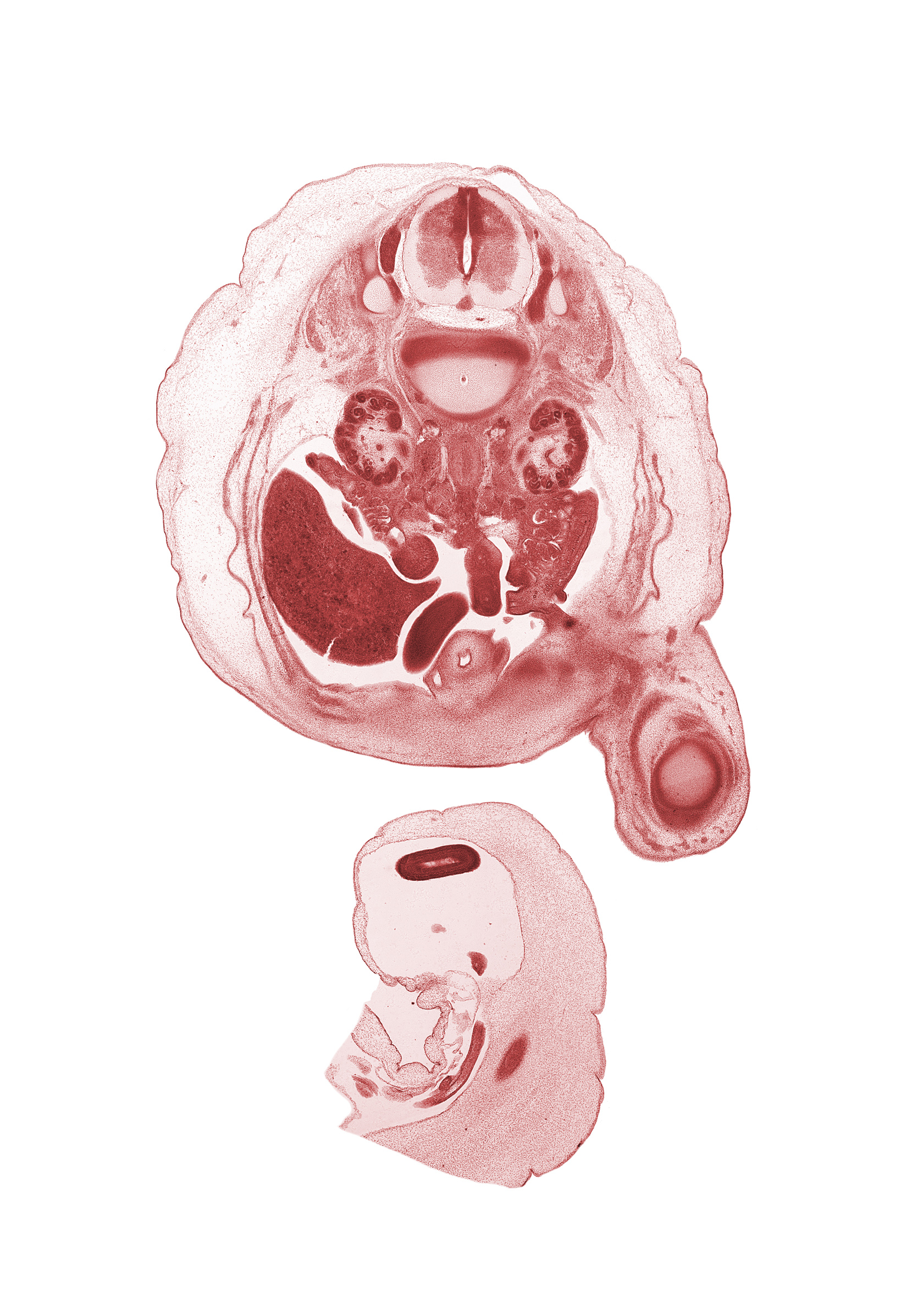 L-1 / L-2 intervertebral disc, L-1 spinal ganglion, L-1 spinal nerve, L-1 ventral root, L-2 spinal ganglion, aorta, caudal edge of junction of duodenum and jejunum, edge of omphalomesenteric artery, epididymis, femur, gubernaculum of testis, hilum of kidney (metanephros), hindgut, inferior vena cava (subcardinal vein), left umbilical artery, proximal limb of herniated midgut, right lobe of liver, right umbilical artery, sartorius muscle, sympathetic trunk, testis, umbilical cord, ureter, urinary bladder, vas deferens (mesonephric duct)