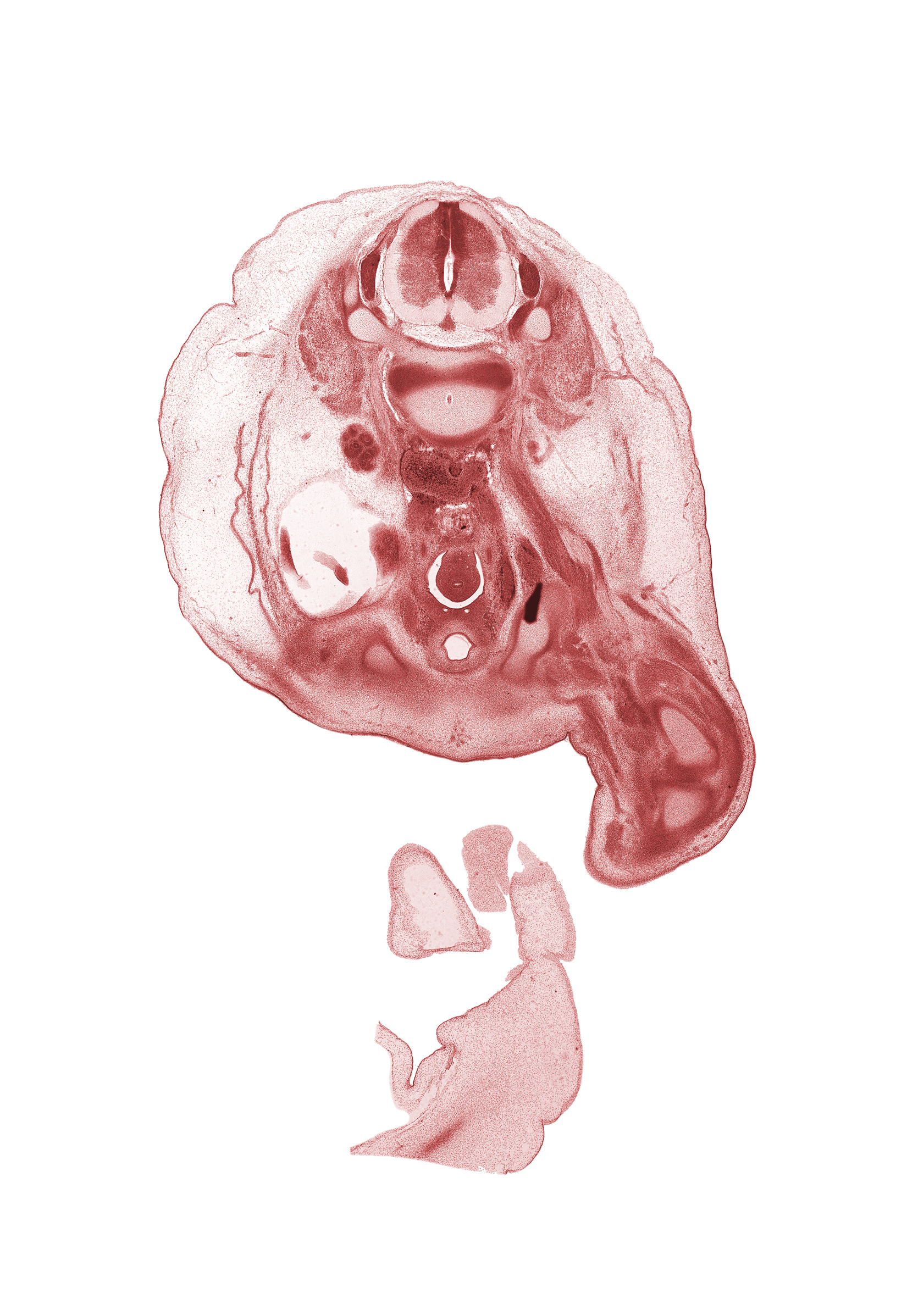 L-2 / L-3 intervertebral disc, L-2 dorsal root, L-2 spinal ganglion, L-2 spinal nerve, L-3 spinal ganglion, aorta, centrum of L-3 vertebra, femur, gubernaculum of testis, inferior pole of kidney (metanephros), junction of ureter and urinary bladder, knee joint, neural arch, peritoneal cavity, sigmoid colon, subarachnoid space, testis, tibia, umbilical coelom, umbilical cord, urinary bladder, vas deferens (mesonephric duct)