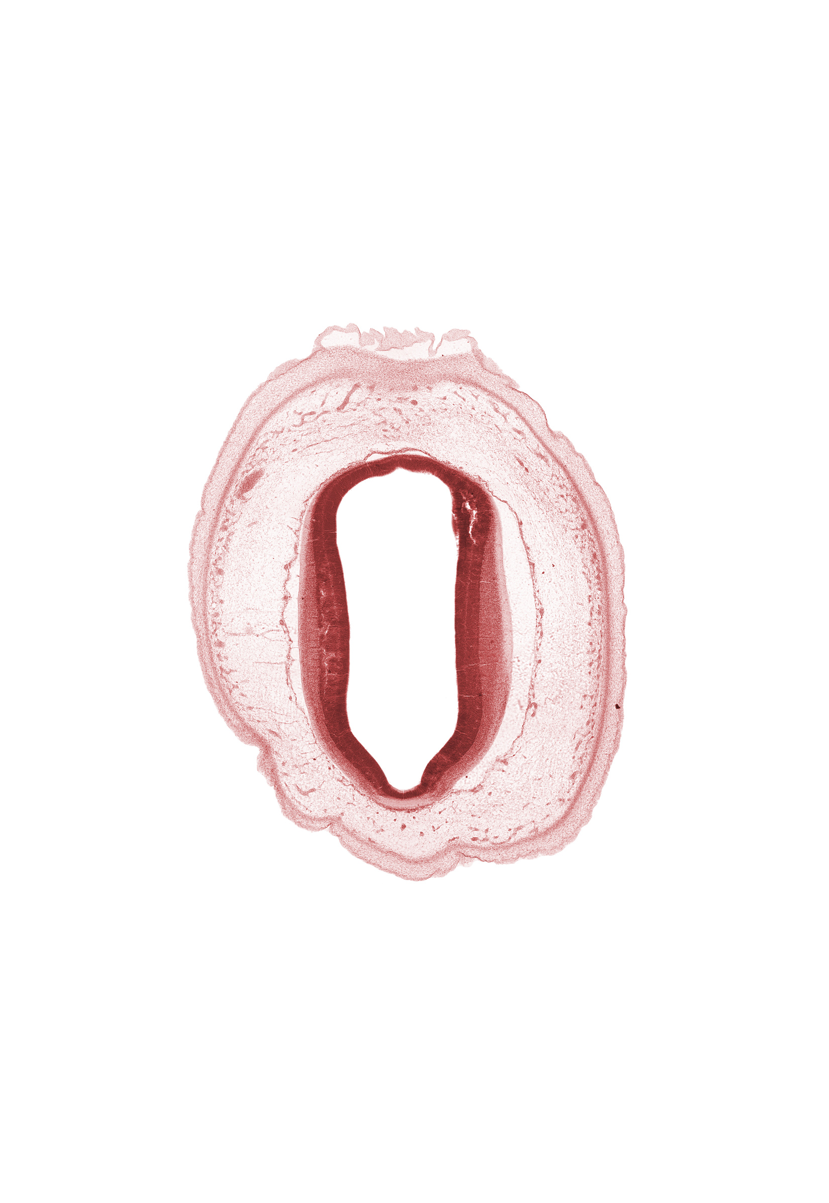 artifact fracture(s), artifact separation(s), commissure of superior colliculus, loose connective tissue, osteogenic layer, subarachnoid space, surface ectoderm