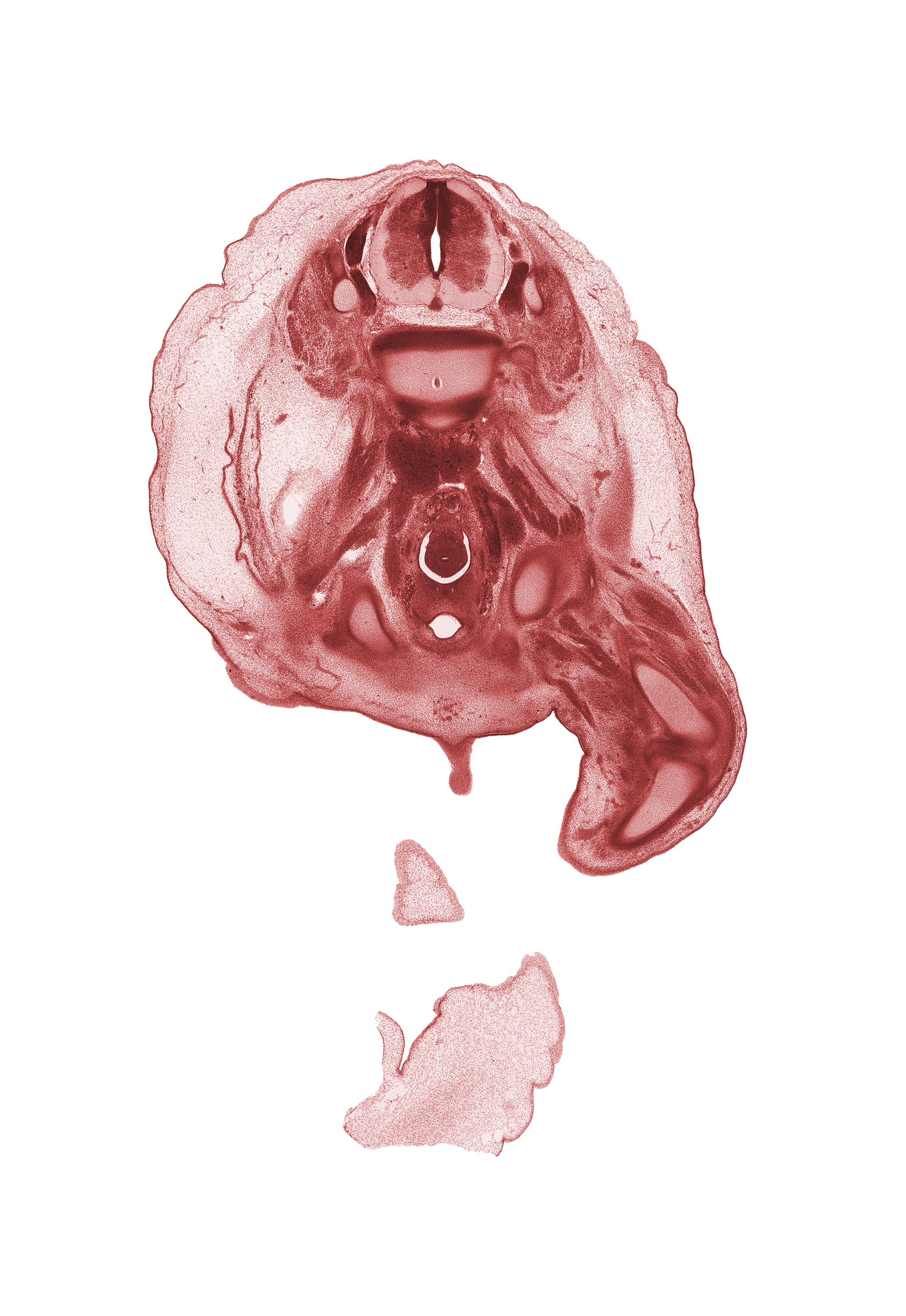 L-2 spinal ganglion, L-3 / L-4 intervertebral disc, L-3 spinal ganglion, L-3 spinal nerve, aorta, caudal edge of umbilical coelom, caudal edge of umbilical cord, cephalic edge of penis, femoral artery, femoral nerve, femur, gubernaculum of testis, inferior vena cava (sacrocardinal vein), intermediate zone, knee joint, marginal zone, mesosigmoid, notochord, psoas major muscle, sigmoid colon, tibia, ureter, urinary bladder, vas deferens (mesonephric duct), ventricular zone