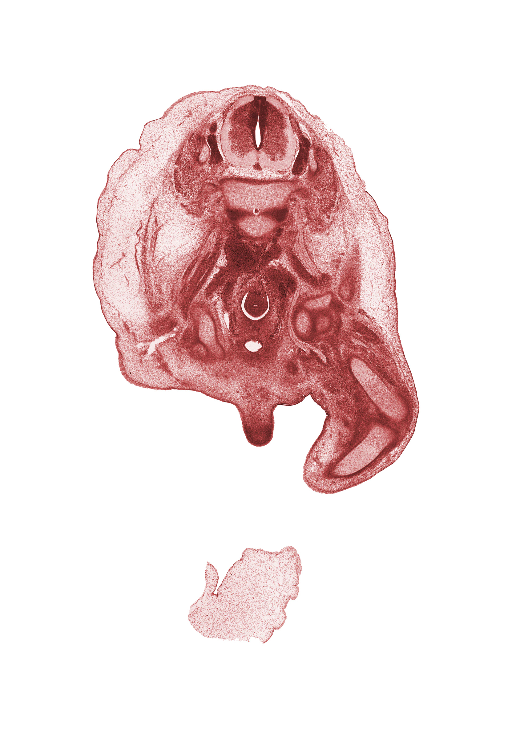 L-3 / L-4 intervertebral disc, L-3 spinal ganglion, L-3 spinal nerve, adductor muscles, external iliac vessels, femoral nerve, femur, gubernaculum of testis, internal iliac vessels, lumbar plexus, notochord, obturator nerve, pubis, scrotal swelling, shaft of penis, sigmoid colon, tibia, urinary bladder