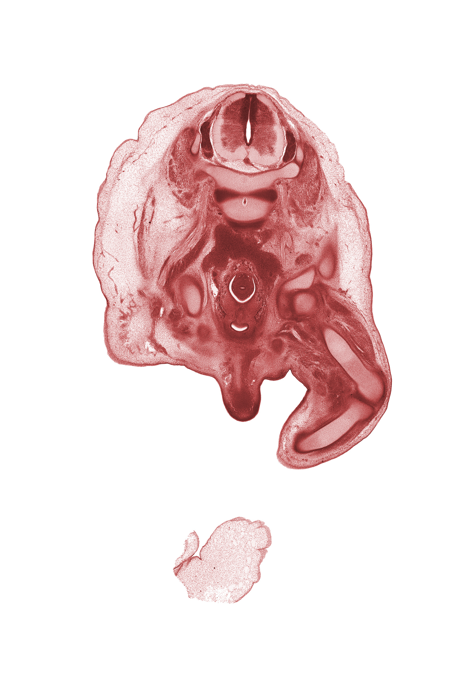 L-3 / L-4 intervertebral disc, L-3 spinal ganglion, L-3 spinal nerve, anterior spinal artery, aortic bifurcation, base of urinary bladder, blastemata of adductor muscles, common iliac artery, corpus cavernosum, femur, gubernaculum of testis, inferior vena cava (sacrocardinal vein), knee joint, neural canal, pubis, quadriceps femoris muscle, scrotal swelling, shaft of penis, sigmoid colon, tibia, ureter