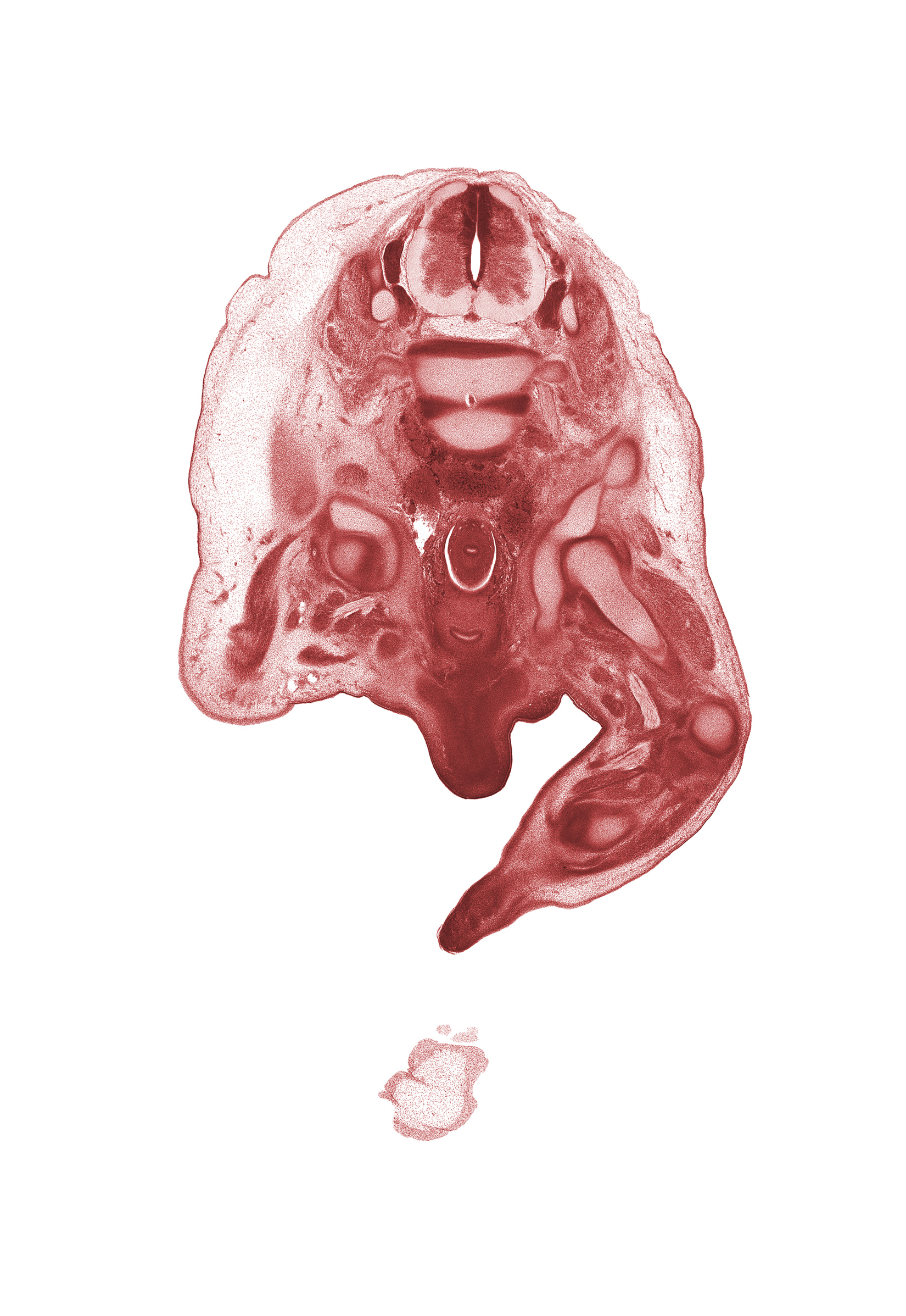 L-3 dorsal root, L-3 spinal ganglion, L-4 / L-5 intervertebral disc, L-4 spinal ganglion, L-4 spinal nerve, corpus cavernosum, hip joint, junction of rectum and sigmoid colon, lateral epicondyle of femur, neural arch, peritoneal cavity, sciatic nerve, scrotal swelling, shaft of penis, tibia, tibial nerve, urethra