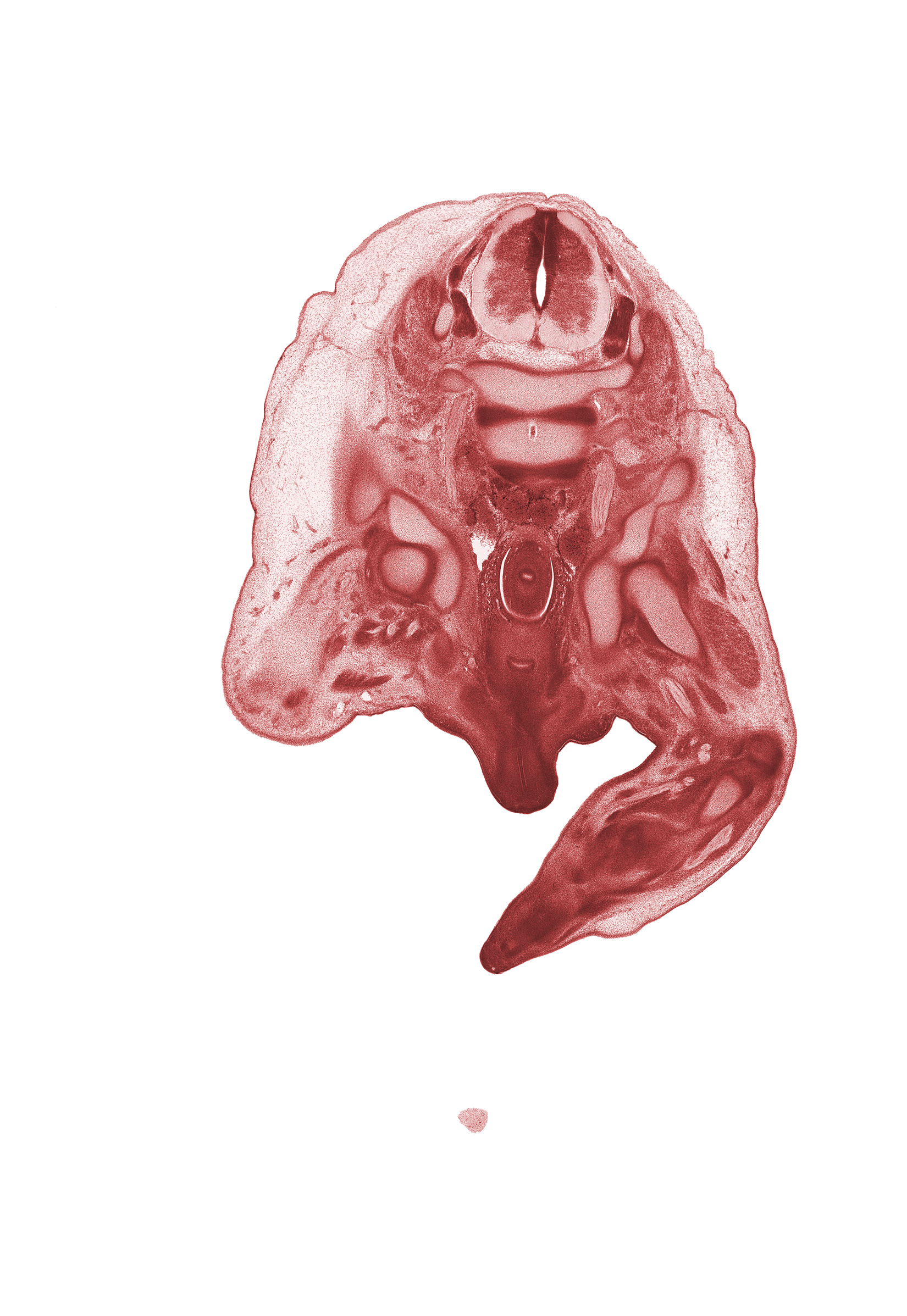 L-4 / L-5 intervertebral disc, L-4 spinal ganglion, L-4 spinal nerve, centrum of L-5 vertebra, femur, fibula, hip joint, ilium, internal iliac vein, ischium, lumbosacral trunk, neural arch, notochord, osteogenic layer, popliteal artery, rectum, scrotal swelling, shaft of penis, urethra