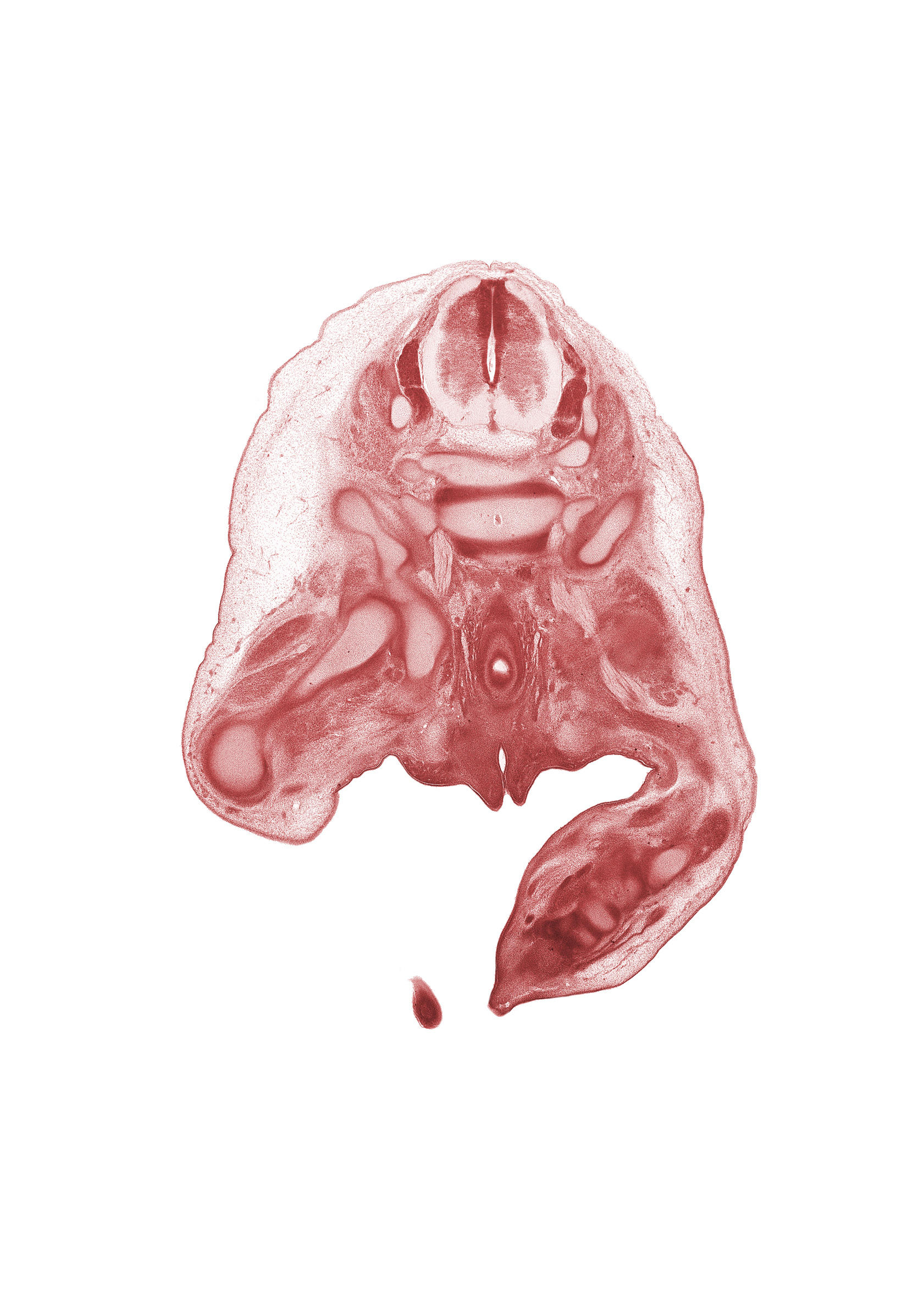 L-4 spinal ganglion, L-5 / S-1 intervertebral disc, L-5 spinal ganglion, L-5 spinal nerve, S-1 / S-2 intervertebral region, S-1 spinal nerve, ala of sacrum, cephalic edge of right foot, fibula, ilium, ischium, levator ani muscle, marginal vein, rectum, sacral plexus, sciatic nerve, scrotal swelling, subarachnoid space, tarsal cartilage(s), urethra, urethral fold, urethral groove