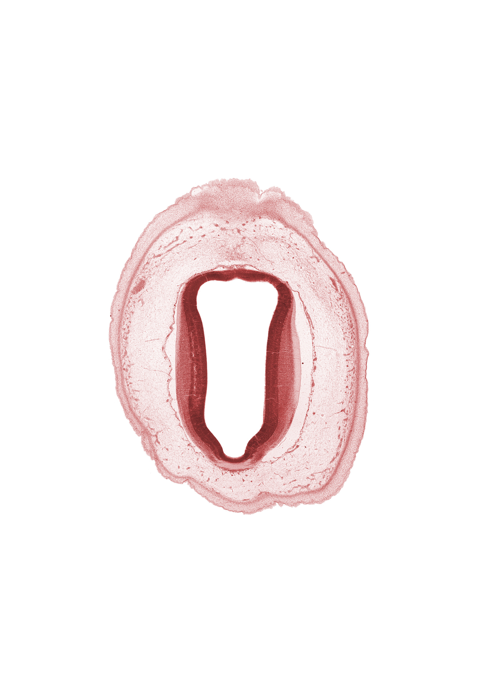 artifact separation(s), cerebral aqueduct (mesocoele), commissure of superior colliculus, roof plate of mesencephalon, tectum