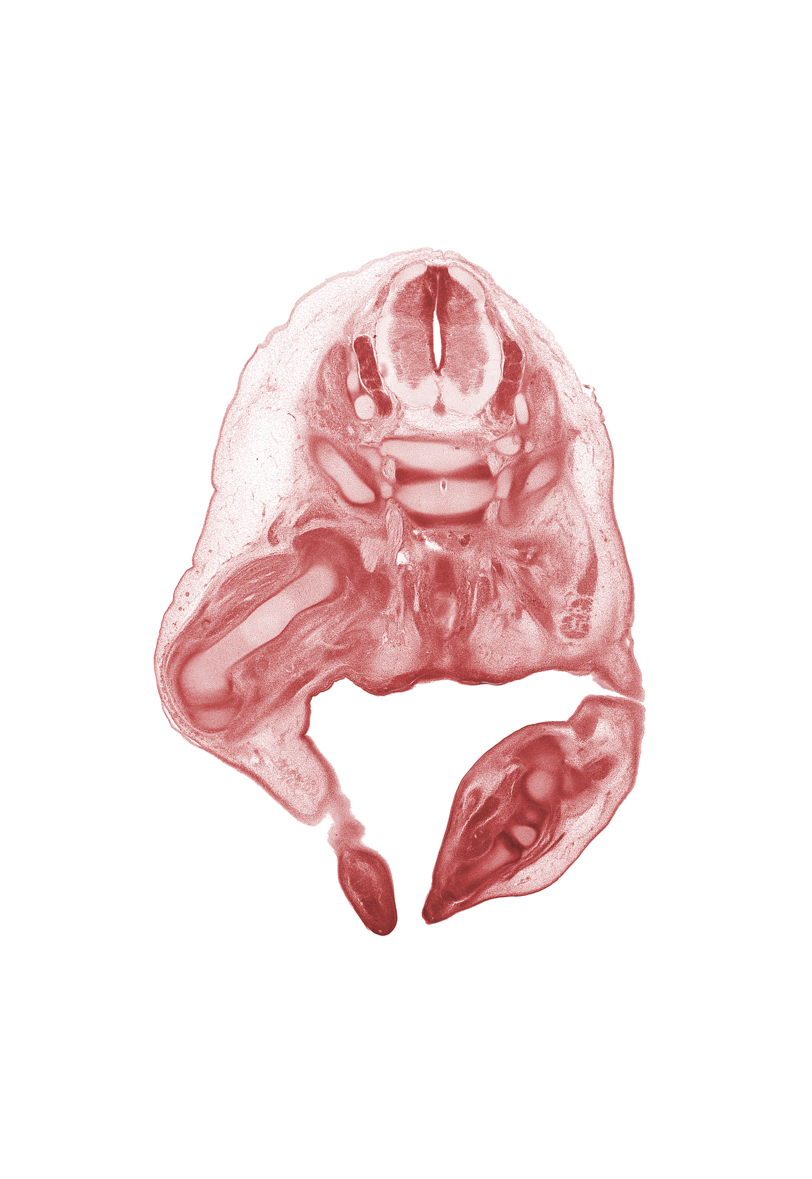 L-5 spinal ganglion, S-1 / S-2 intervertebral region, S-1 spinal ganglion, S-1 spinal nerve, S-2 / S-3 intervertebral region, S-2 spinal nerve, anal canal, anal pit, central canal, extensor tendon of foot, femur, intermediate zone, marginal zone, rectum, scrotal swelling, subarachnoid space, ventricular zone