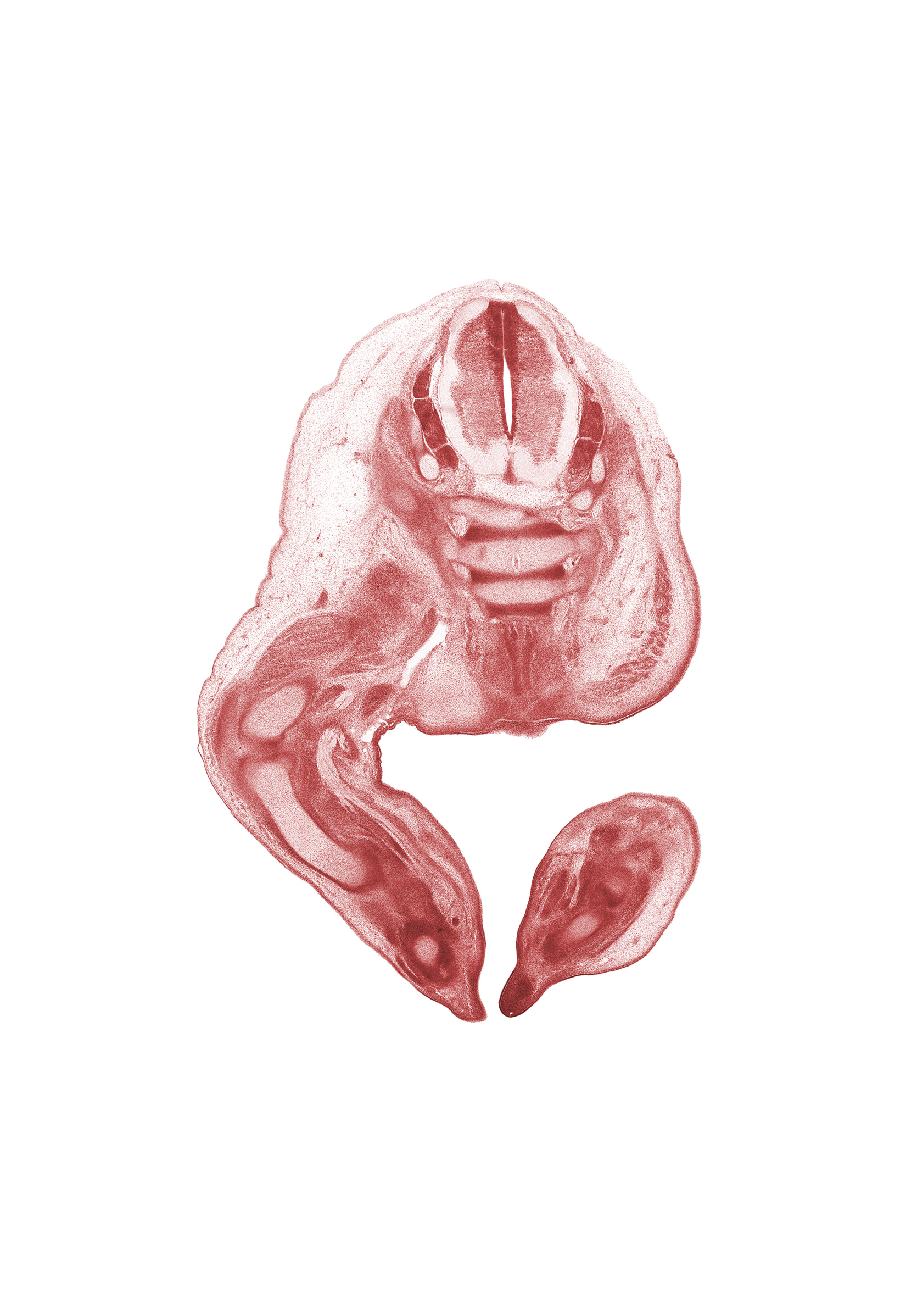 S-1 spinal ganglion, S-2 / S-3 intervertebral region, S-2 spinal ganglion, S-2 spinal nerve, S-3 / S-4 intervertebral region, S-3 spinal nerve, S-4 / S-5 intervertebral region, S-4 spinal nerve, femur, gluteus maximus muscle, marginal vein, metatarsal cartilage, tibia, tibial nerve