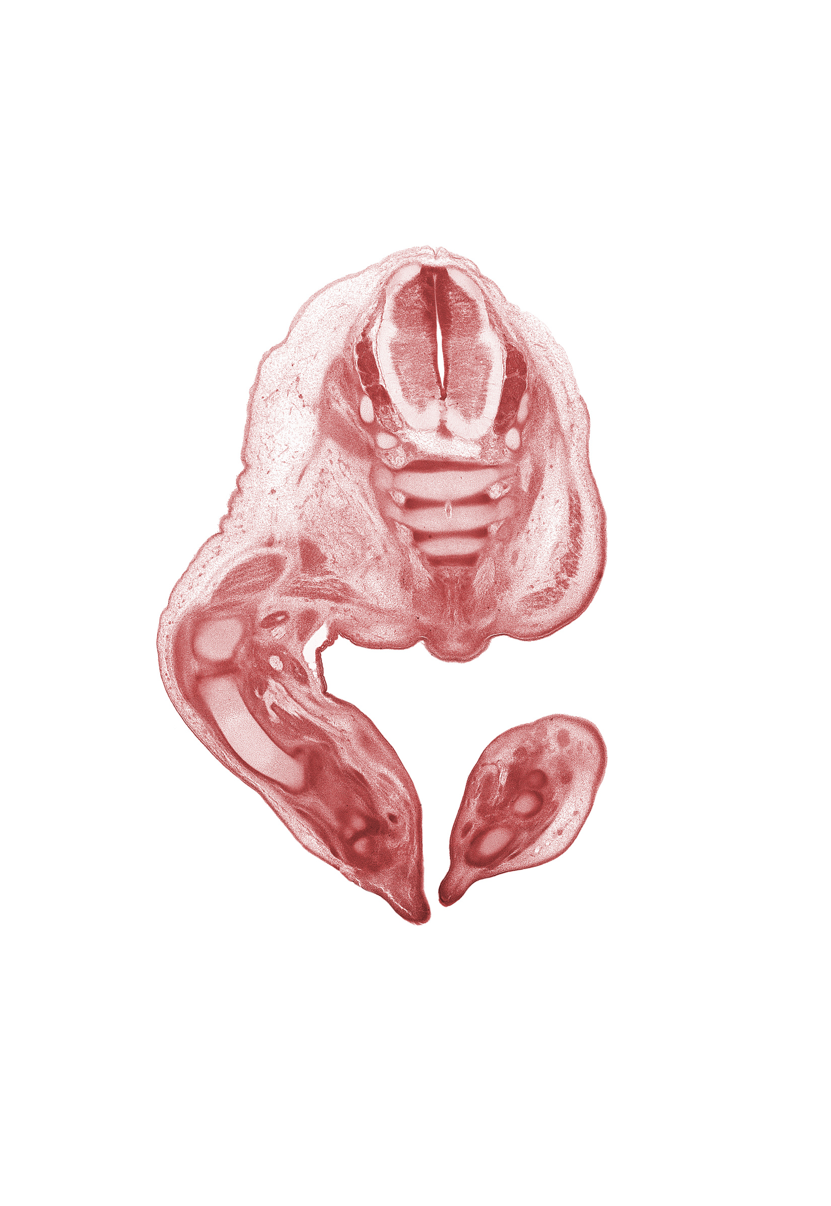 S-1 dorsal root, S-1 spinal ganglion, S-2 / S-3 intervertebral region, S-2 spinal ganglion, S-2 spinal nerve, S-3 / S-4 intervertebral region, S-3 spinal nerve, S-4 / S-5 intervertebral region, S-4 spinal nerve, S-5 / Co-1 intervertebral region, caudal eminence, central canal, dorsum of foot, gluteus maximus muscle, metatarsal cartilage, neural arch, notochord, plantar surface of foot, subarachnoid space, tarsal cartilage(s), tibia