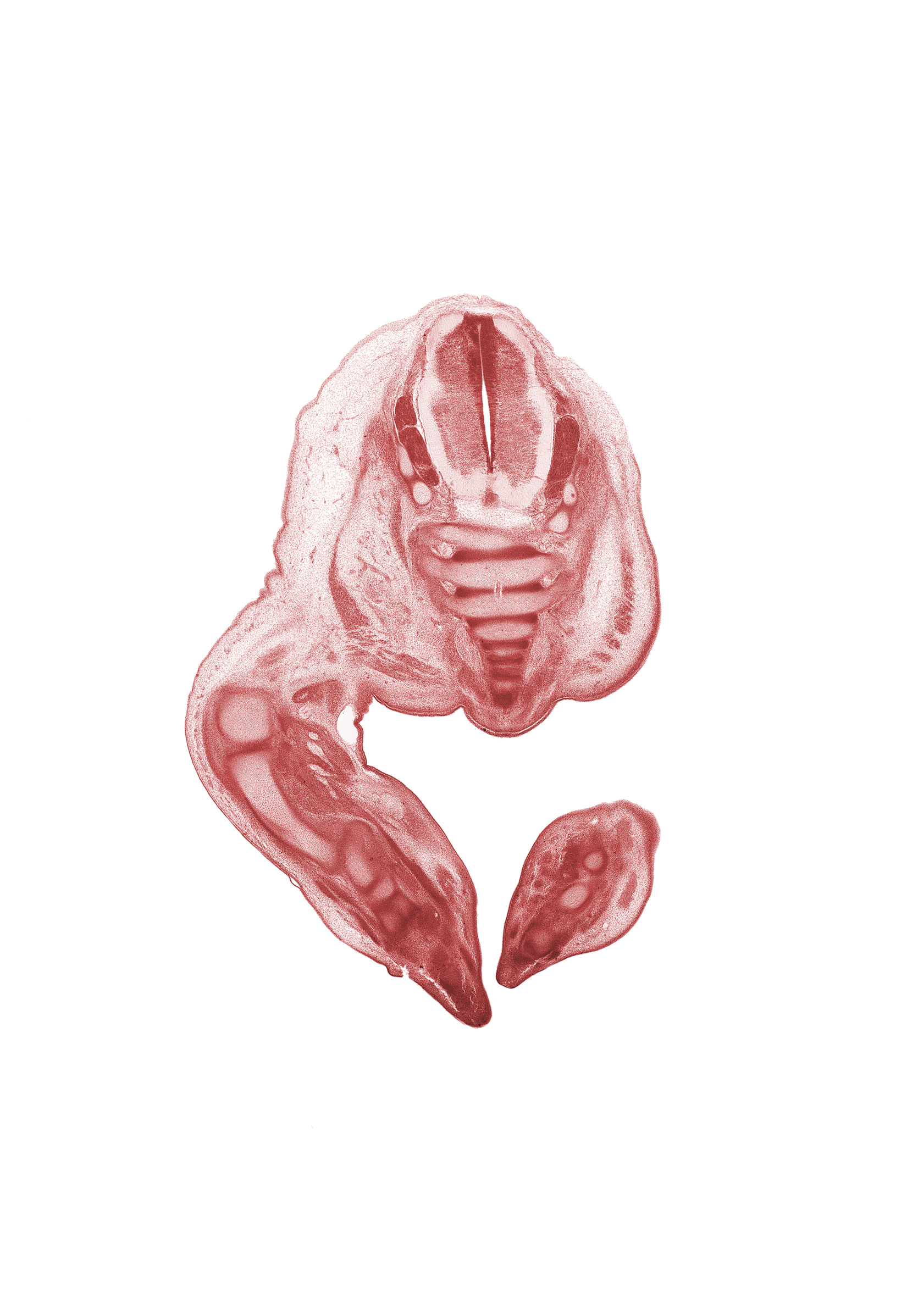 Co-1 / Co-2 intervertebral region, Co-1 spinal nerve, Co-2 / Co-3 intervertebral region, S-1 dorsal root, S-1 spinal ganglion, S-2 spinal ganglion, S-3 / S-4 intervertebral region, S-3 spinal ganglion, S-3 spinal nerve, S-4 / S-5 intervertebral region, S-4 spinal nerve, S-5 / Co-1 intervertebral region, S-5 spinal nerve, caudal eminence, dorsum of foot, intermediate zone, marginal zone, neural arch, notochord, plantar surface of foot, ventricular zone