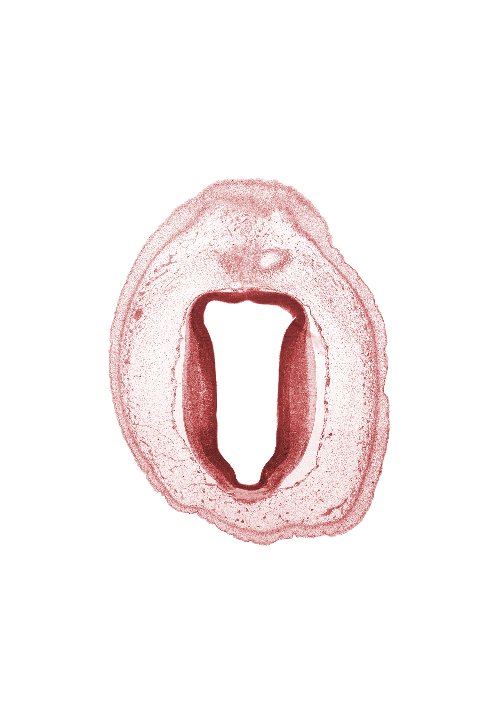 artifact separation(s), cerebral aqueduct (mesocoele), commissure of superior colliculus, edge of metencephalon, intermediate zone, loose connective tissue, marginal zone, osteogenic layer, subarachnoid space, surface ectoderm, ventricular zone