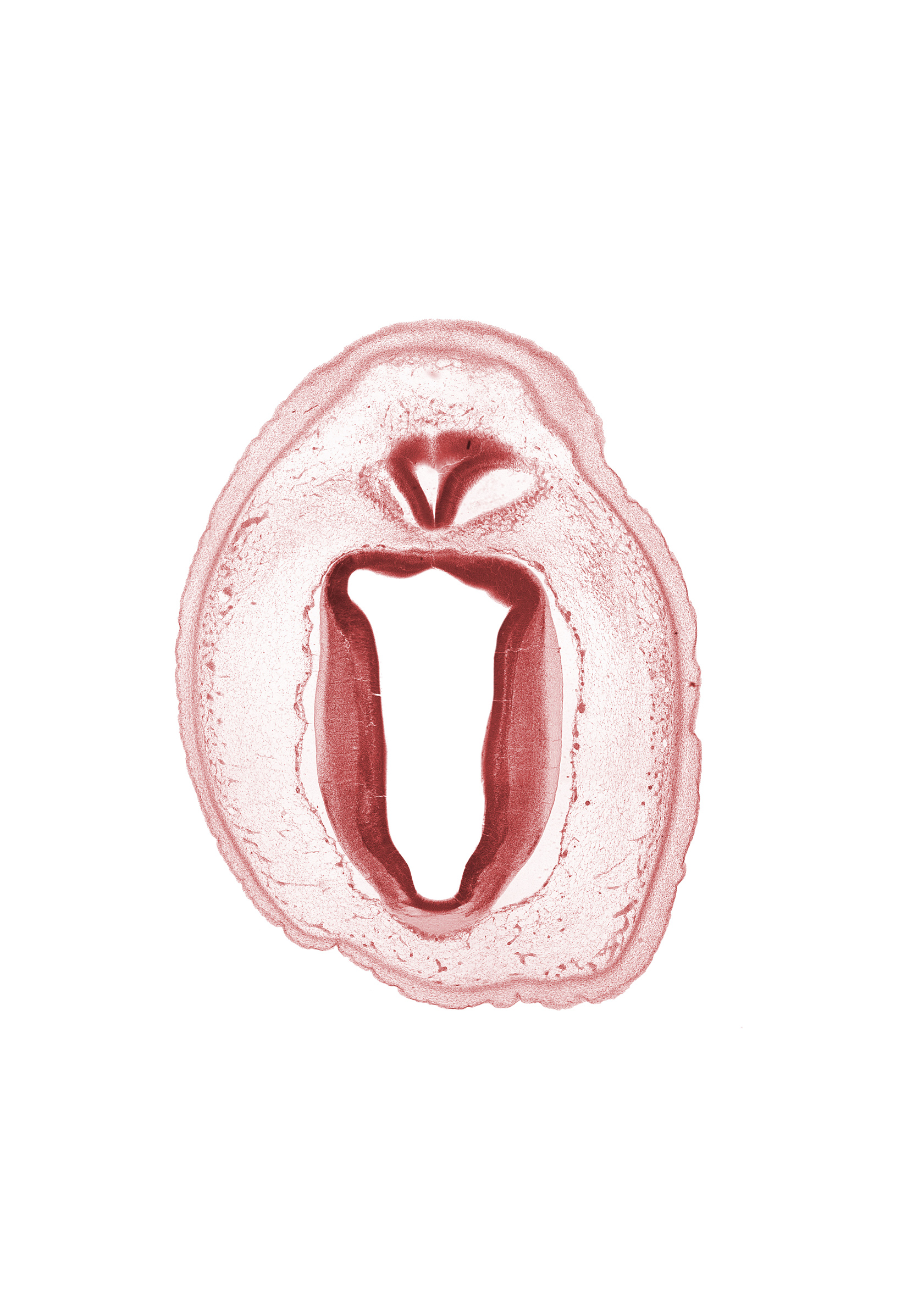 artifact separation(s), cerebral aqueduct (mesocoele), commissure of superior colliculus, edge of rhombencoel (fourth ventricle), metencephalon, subarachnoid space