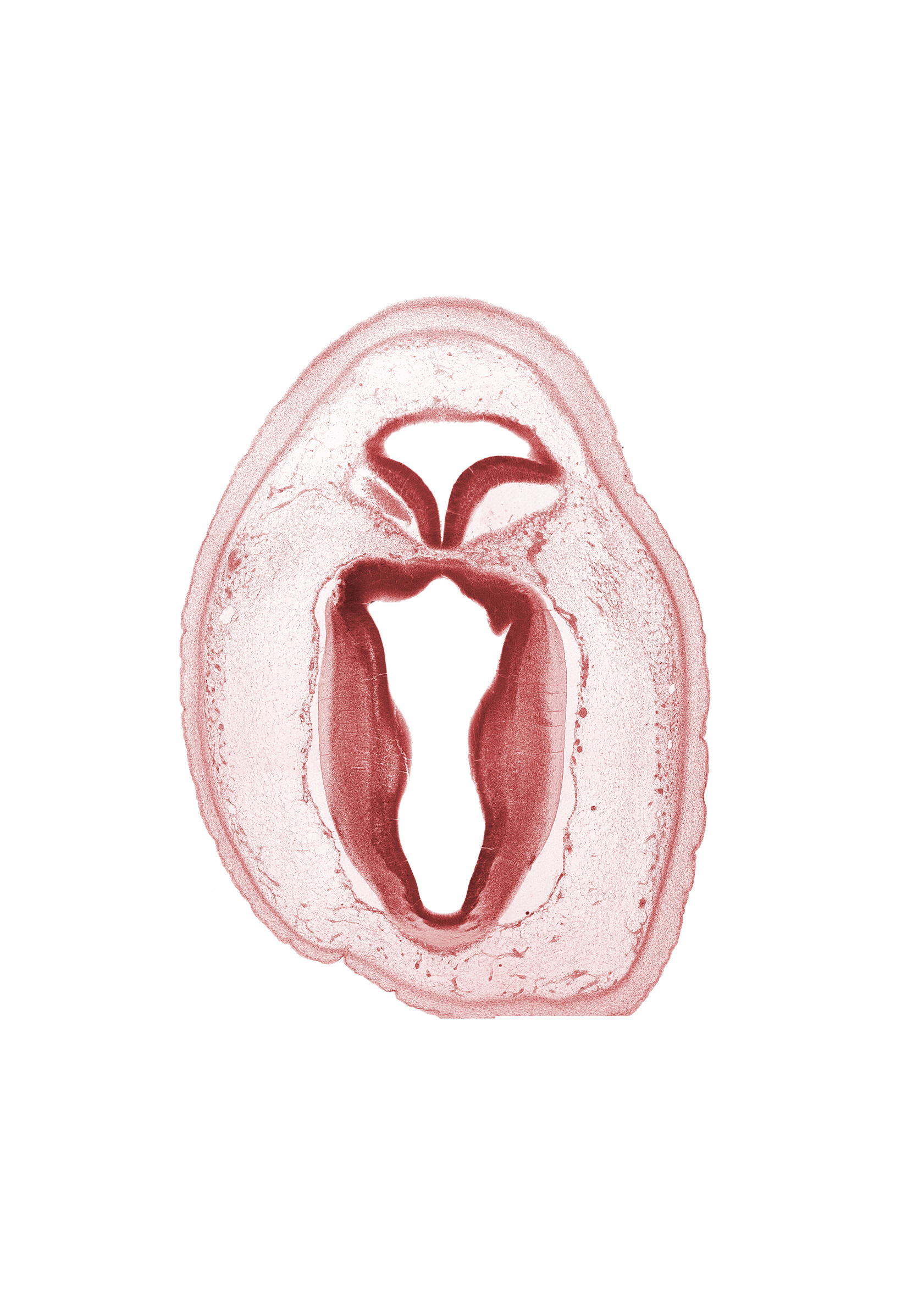 artifact separation(s), commissure of superior colliculus, mesencephalon, metencephalon, osteogenic layer, roof of rhombencoel (fourth ventricle), root of trochlear nerve (CN IV), tectum, tegmentum