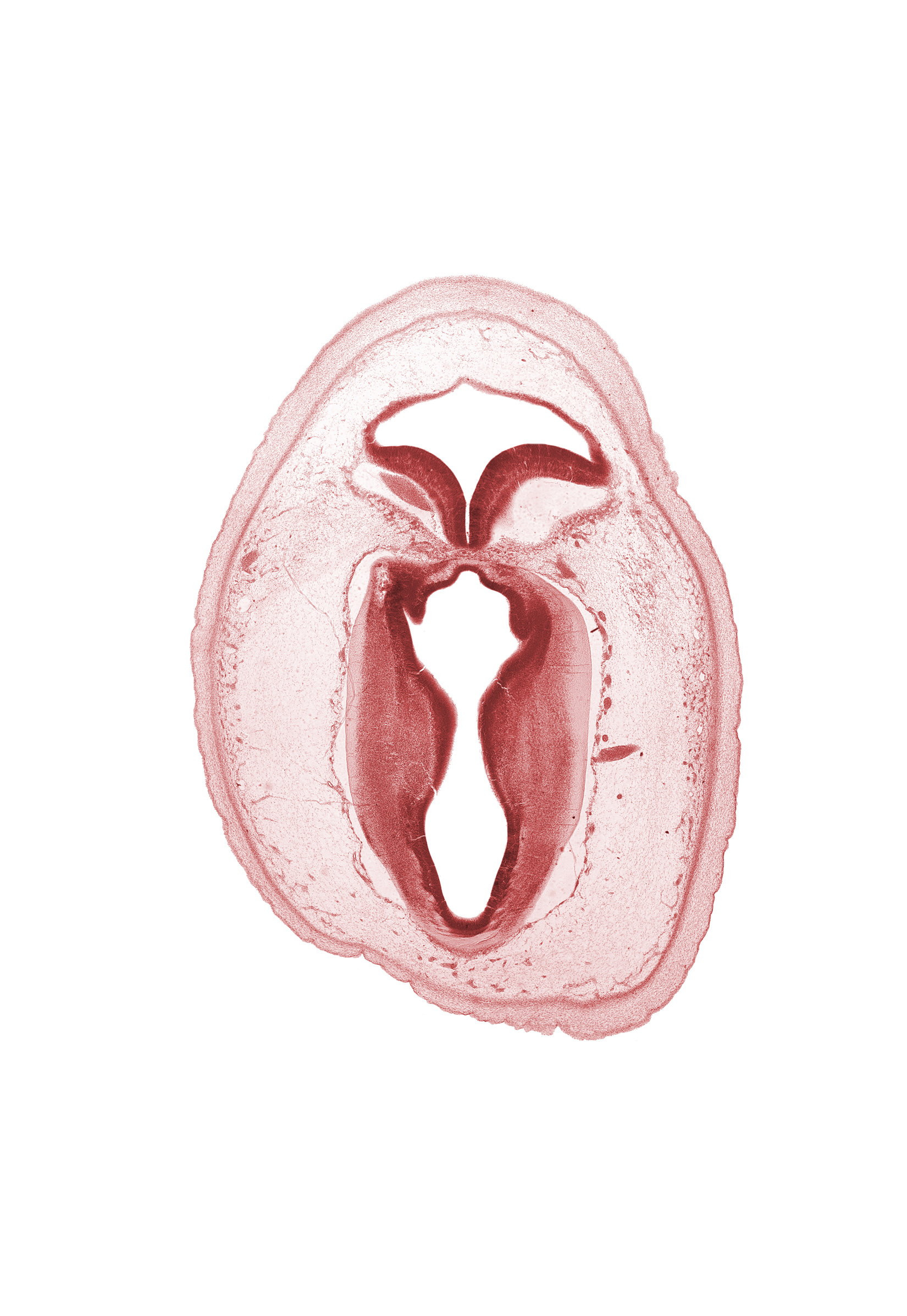 artifact separation(s), cerebral aqueduct (mesocoele), commissure of superior colliculus, intermediate zone, junction of mesencephalon and metencephalon, marginal zone, rhombencoel (fourth ventricle), root of trochlear nerve (CN IV), subarachnoid space, vascular plexus, ventricular zone