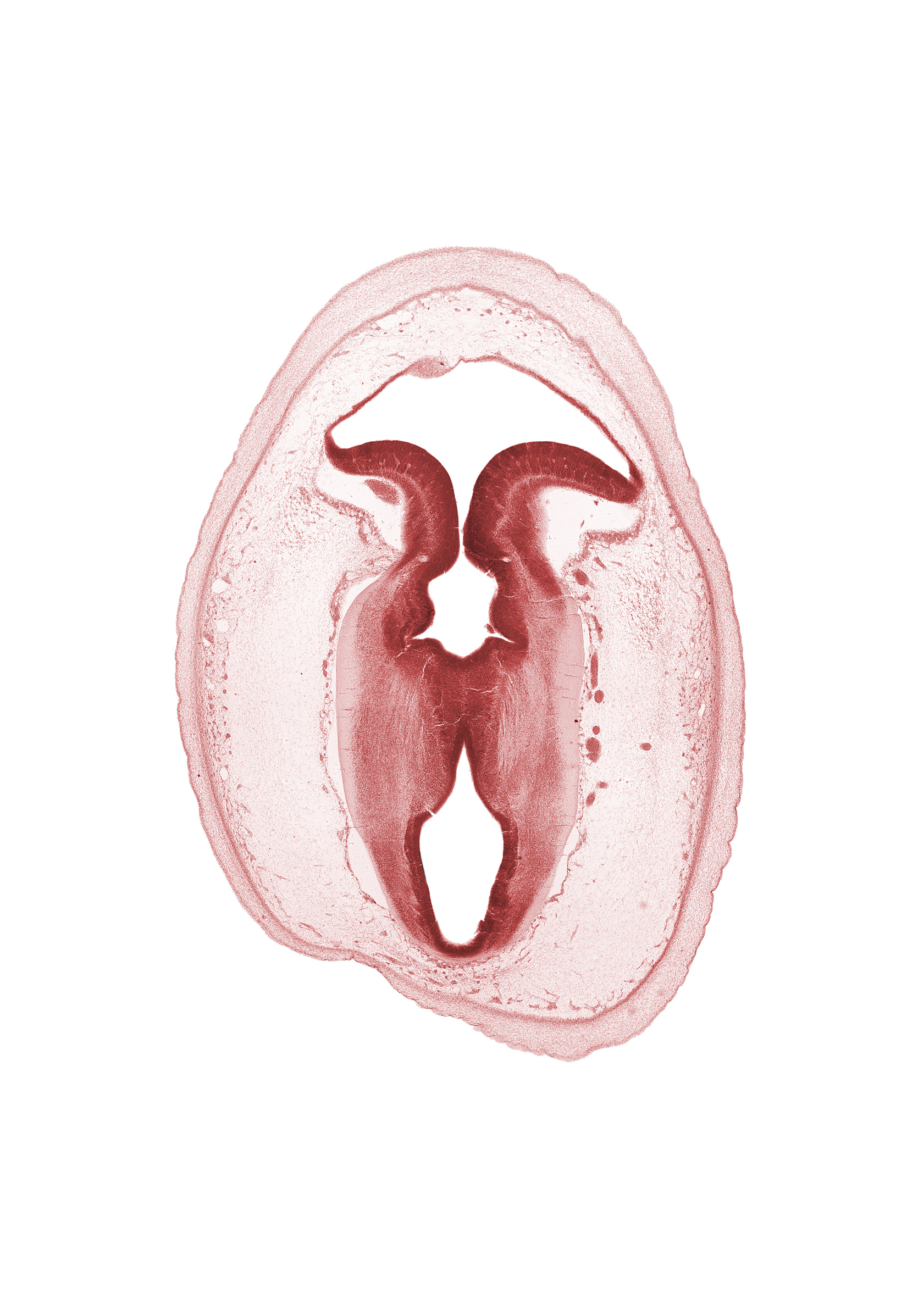 artifact separation(s), cerebral aqueduct (mesencoel), isthmus of metencephalon, rhombencoel (fourth ventricle), roof of rhombencoel (fourth ventricle), subarachnoid space, sulcus limitans, tectum, tegmentum, vascular plexus