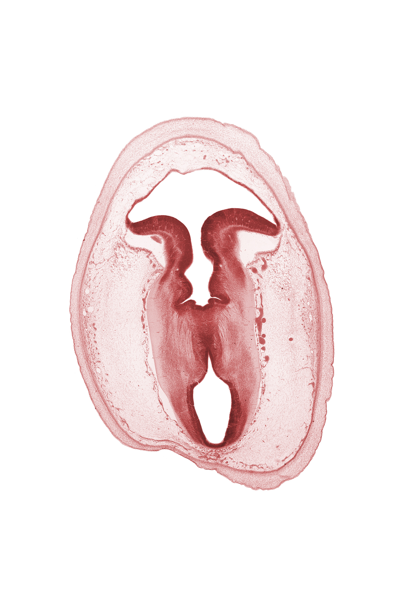 artifact separation(s), cerebral aqueduct (mesocoele), intermediate zone, marginal zone, rhombencoel (fourth ventricle), subarachnoid space, vascular plexus, ventricular zone