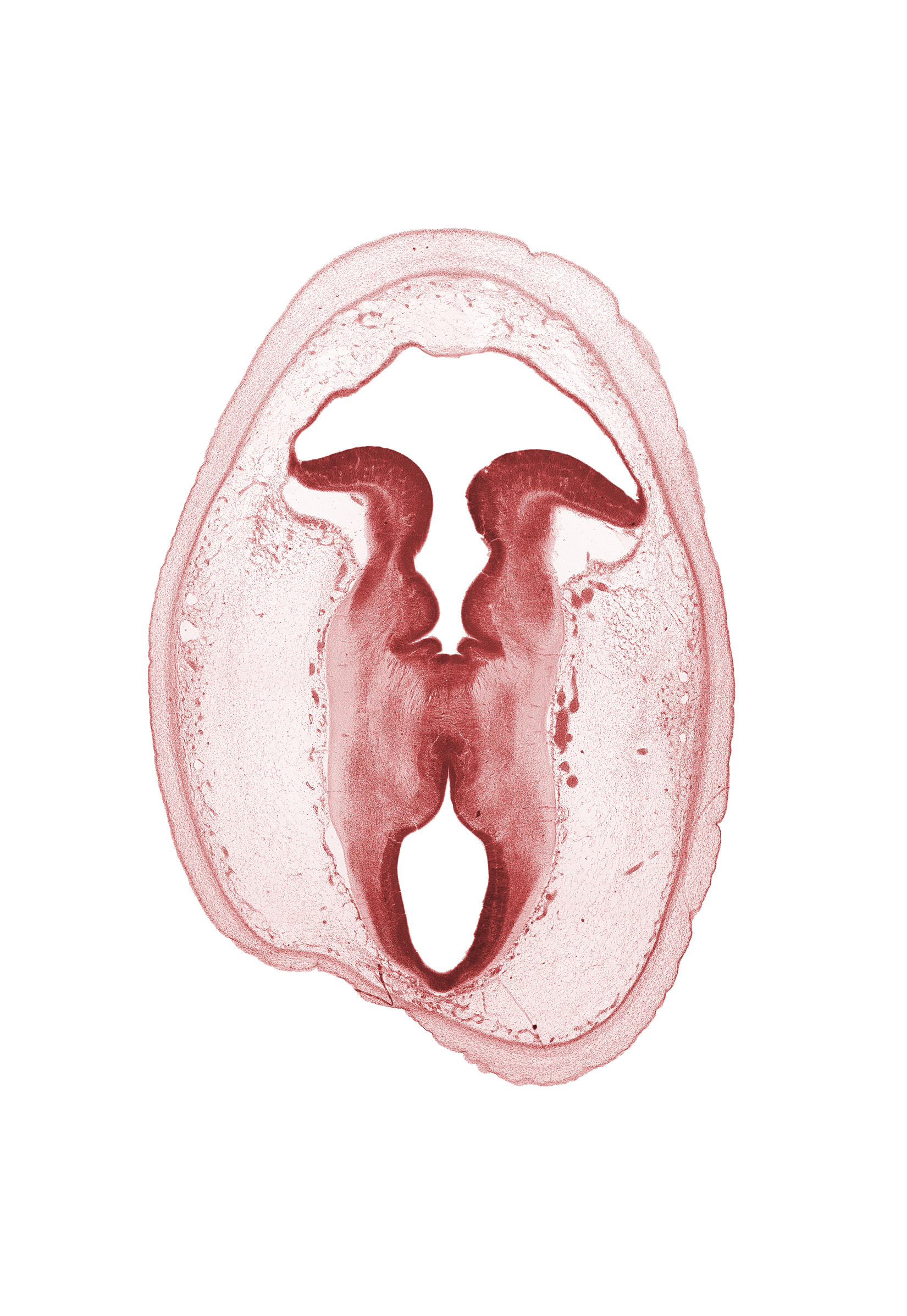 artifact separation(s), cerebral aqueduct (mesocoele), cerebral peduncle, isthmus of metencephalon, mesencephalon, osteogenic layer, rhombencoel (fourth ventricle), subarachnoid space, sulcus limitans, tectum, tegmentum, trochlear nerve (CN IV), vascular plexus