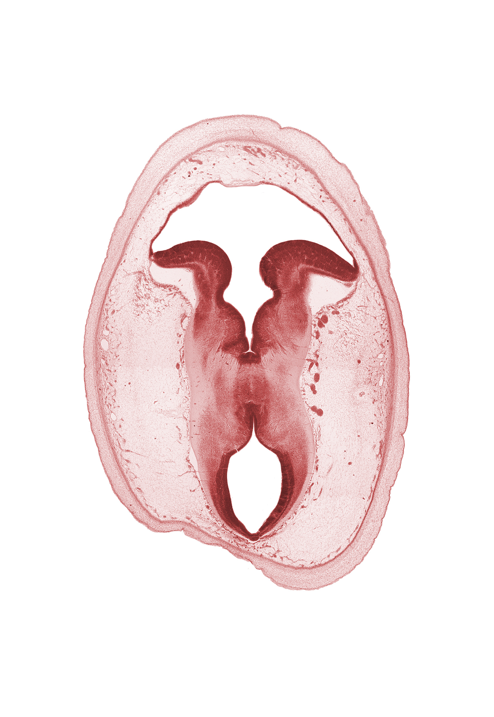 artifact separation(s), cerebral aqueduct (mesocoele), cerebral peduncle, intermediate zone, loose connective tissue, marginal zone, osteogenic layer, rhombencoel (fourth ventricle), sulcus limitans, surface ectoderm, trochlear nerve (CN IV), ventricular zone