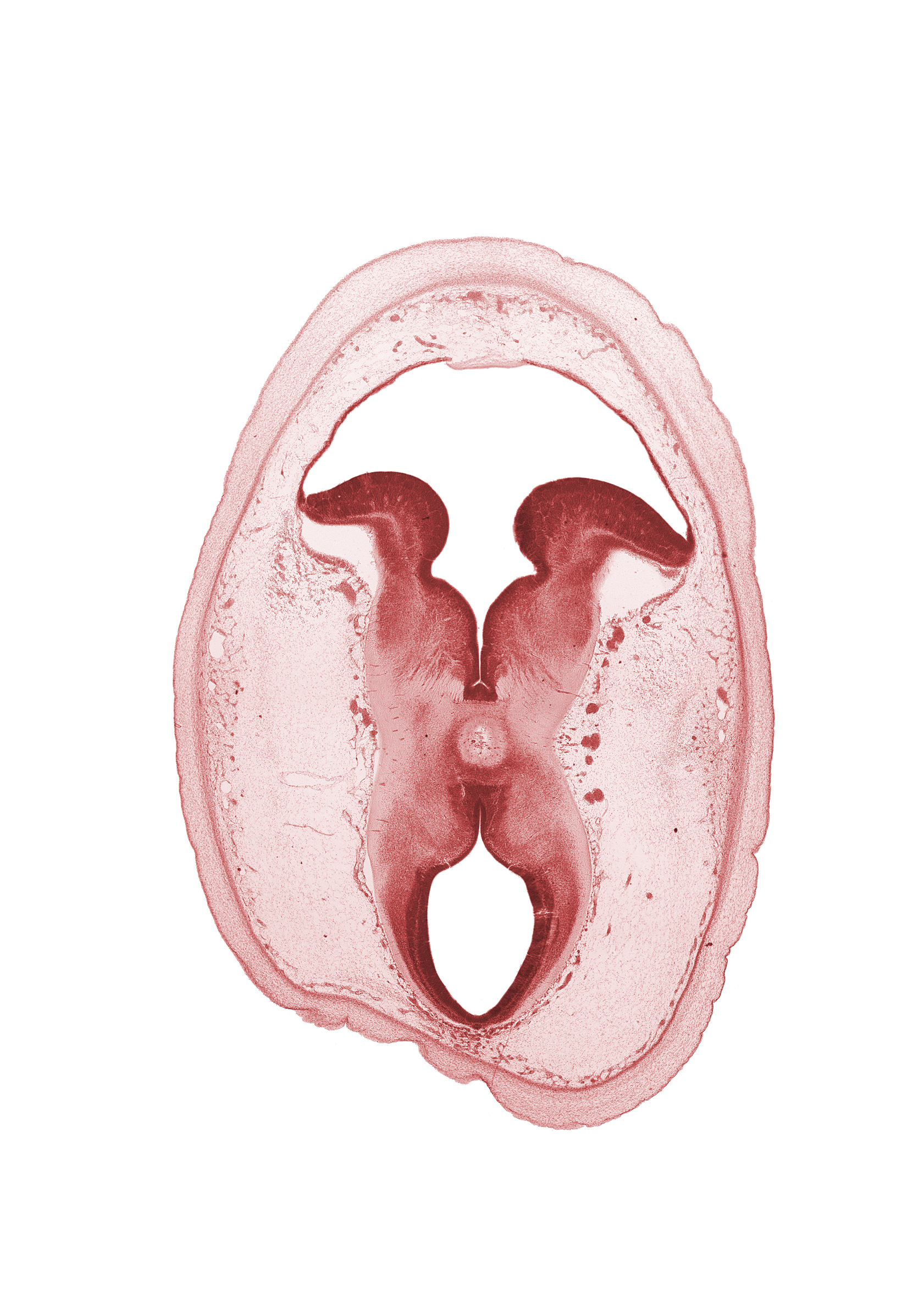 artifact separation(s), dural limiting membrane, edge of interpeduncular fossa, intermediate zone, loose connective tissue, marginal zone, osteogenic layer, subarachnoid space, sulcus limitans, surface ectoderm, tectum, tegmentum, trochlear nerve (CN IV), vascular plexus, ventricular zone