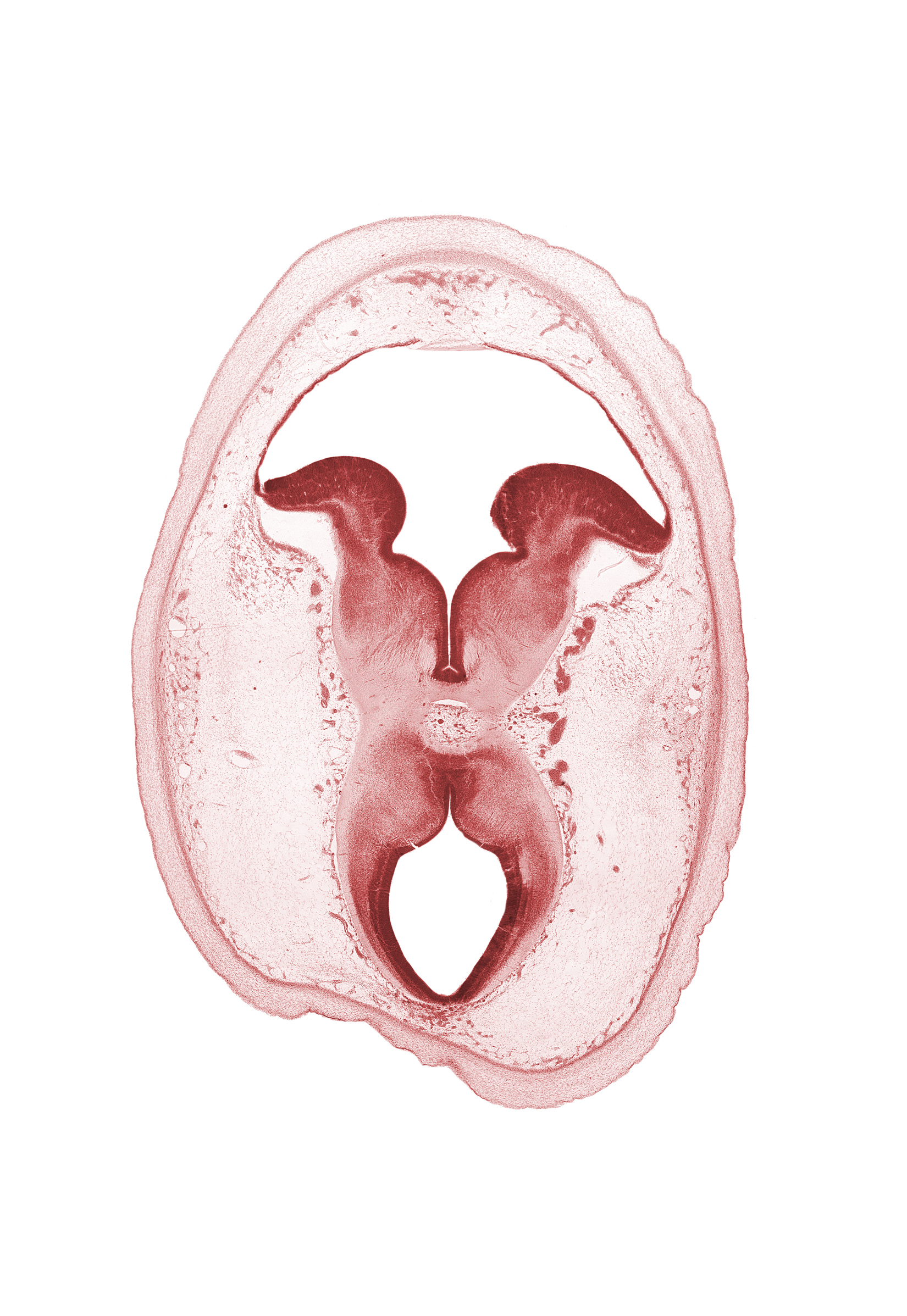 alar plate(s), artifact separation(s), basal plate, cerebral peduncle, floor plate, interpeduncular fossa, interpeduncular nucleus, roof of rhombencoel (fourth ventricle), roof plate of mesencephalon, subarachnoid space, sulcus limitans, tectum, tegmentum, trochlear nerve (CN IV)