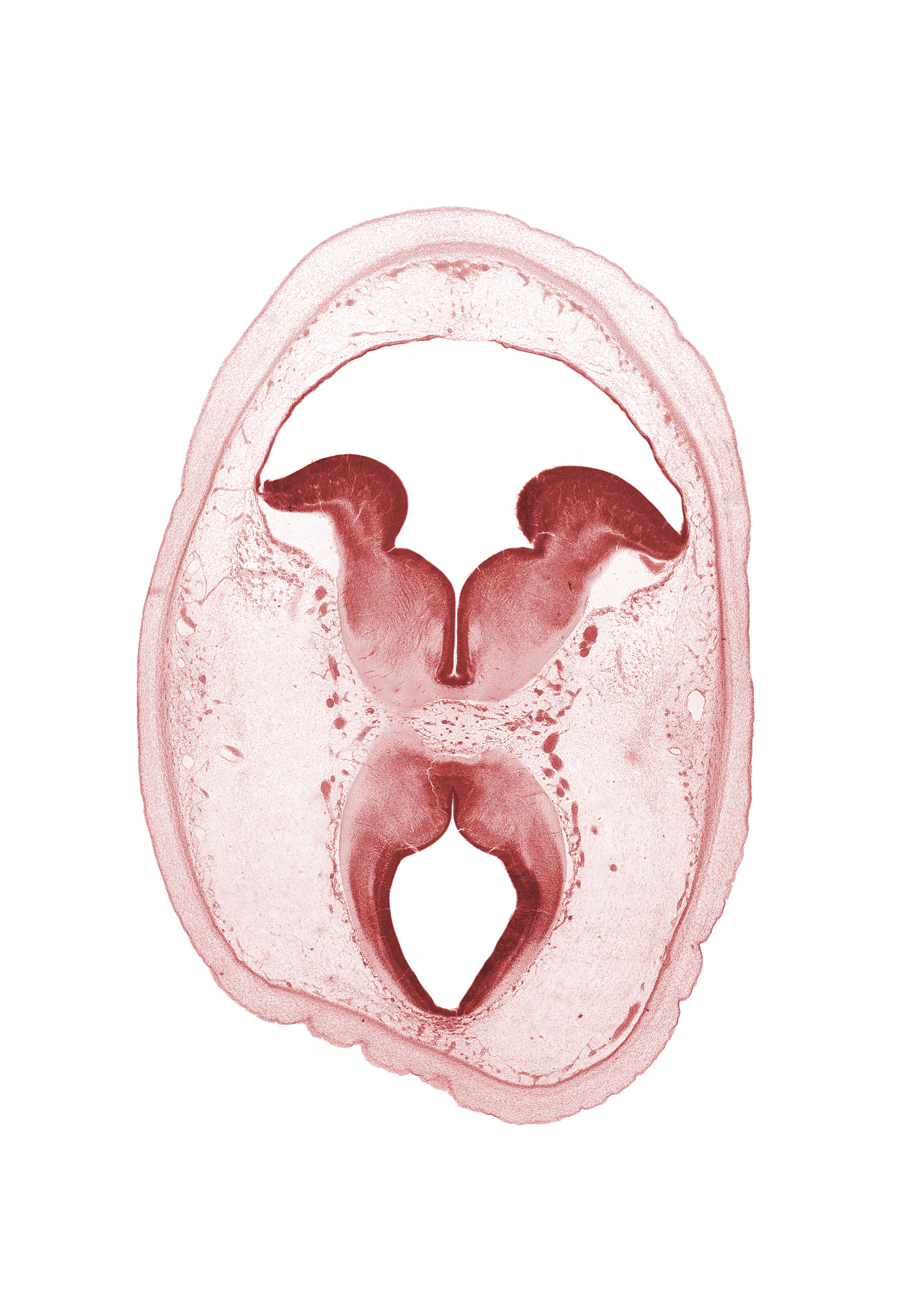 artifact separation(s), basis pedunculi of pons region (metencephalon), cerebral aqueduct (mesocoele), habenulo-interpeduncular tract, osteogenic layer, posterior cerebellar artery, root of oculomotor nerve (CN III), subarachnoid space, sulcus limitans, superior cerebellar artery, surface ectoderm, tectum, tegmentum, trochlear nerve (CN IV), vascular plexus
