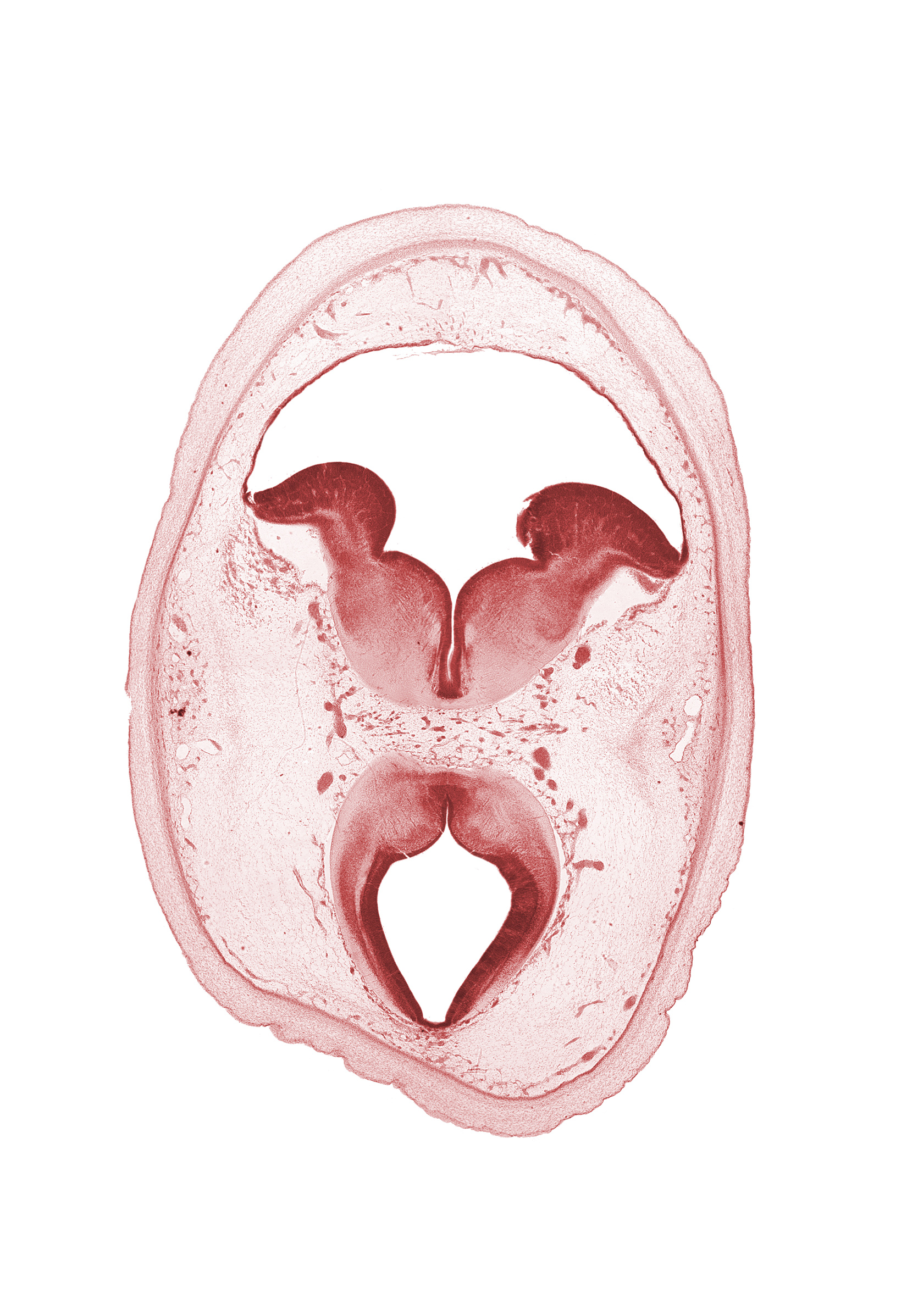 alar plate of metencephalon (cerebellum), artifact separation(s), basal plate, cerebral aqueduct (mesocoele), floor plate, interpeduncular nucleus, median sulcus, mesencephalon, oculomotor nucleus, region of mesencephalic (cephalic) flexure, rhombencoel (fourth ventricle), roof plate, sulcus limitans, superior cerebellar artery, trochlear nerve (CN IV)