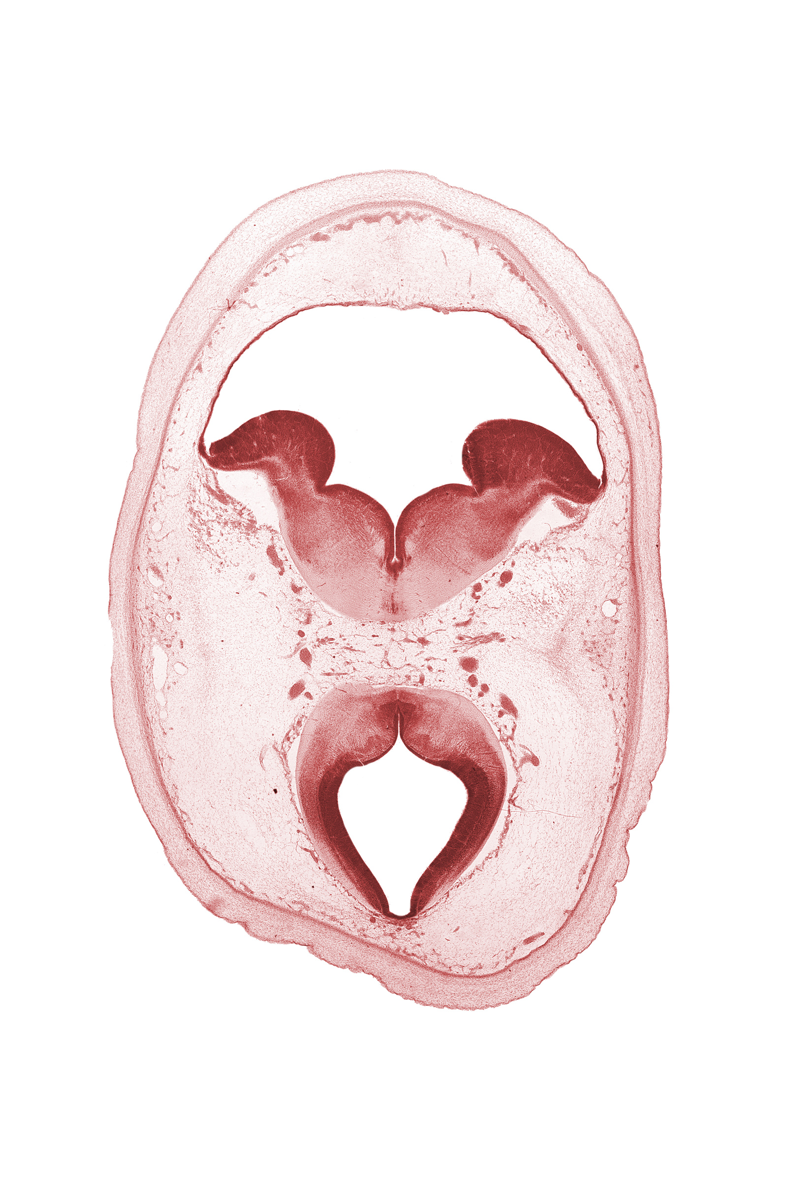 artifact separation(s), cerebral aqueduct (mesocoele), mesencephalon, oculomotor nucleus, osteogenic layer, posterior cerebral artery, roof of rhombencoel (fourth ventricle), root of oculomotor nerve (CN III), subarachnoid space, subcutaneous tissue, surface ectoderm, trochlear nerve (CN IV)