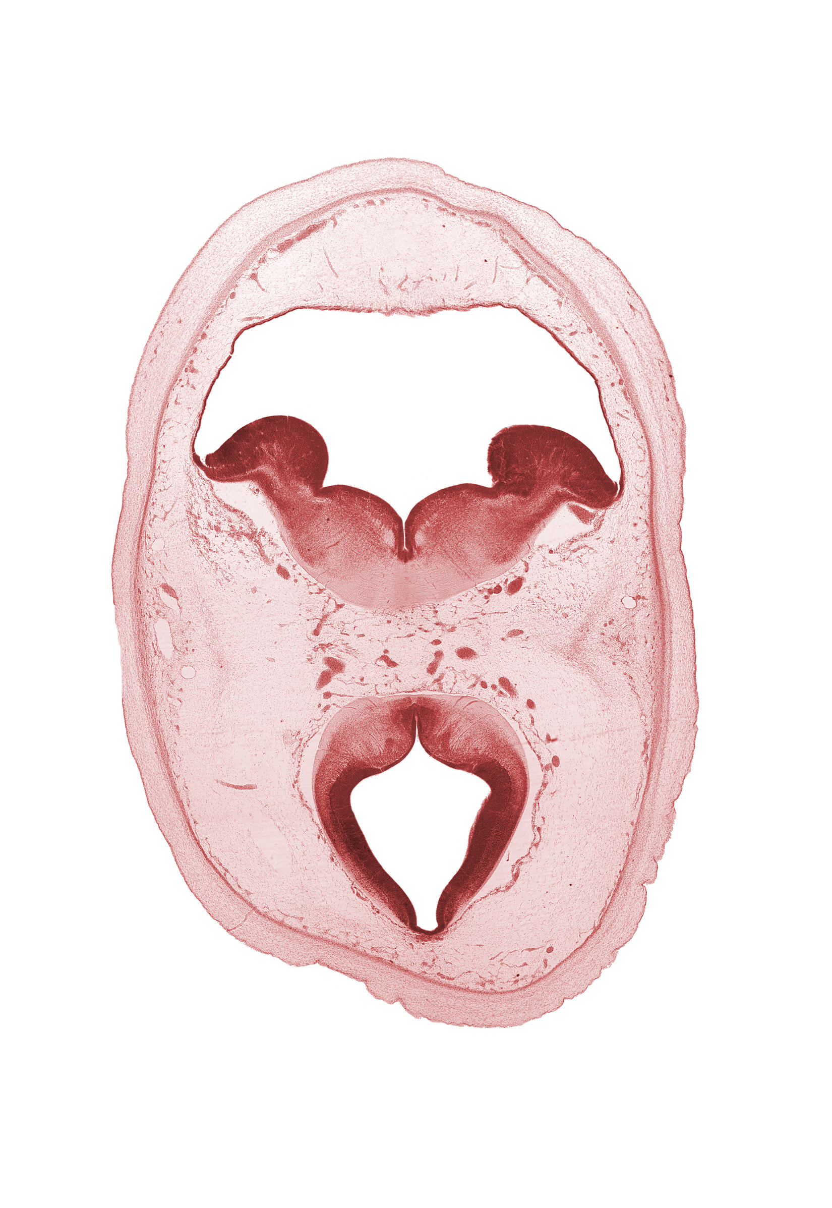 artifact separation(s), diencephalon, dorsal thalamus, junction of cerebral aqueduct and third ventricle, junction of hypothalamic sulcus and sulcus limitans, median sulcus, mesencephalon, oculomotor nerve (CN III), rhombencoel (fourth ventricle), subarachnoid space, sulcus limitans, trochlear nerve (CN IV)