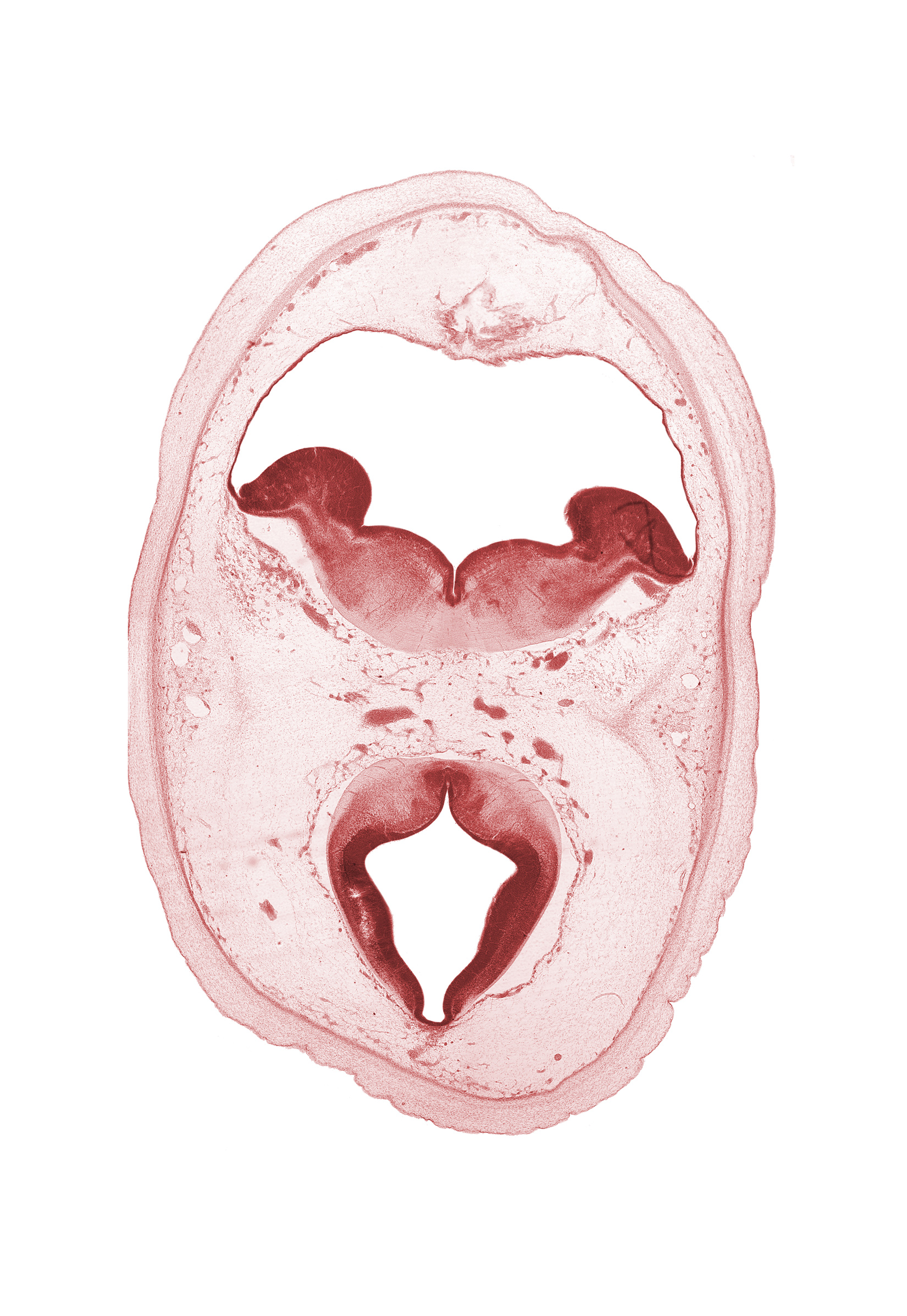 artifact separation(s), basis pedunculi of pons region (metencephalon), diencephalon, dorsal thalamus, edge of ependymal diverticulum of rhombencoel (fourth ventricle), hypothalamic sulcus, metencephalon, oculomotor nerve (CN III), osteogenic layer, posterior cerebral artery, roof of rhombencoel (fourth ventricle), sulcus dorsalis, trochlear nerve (CN IV)