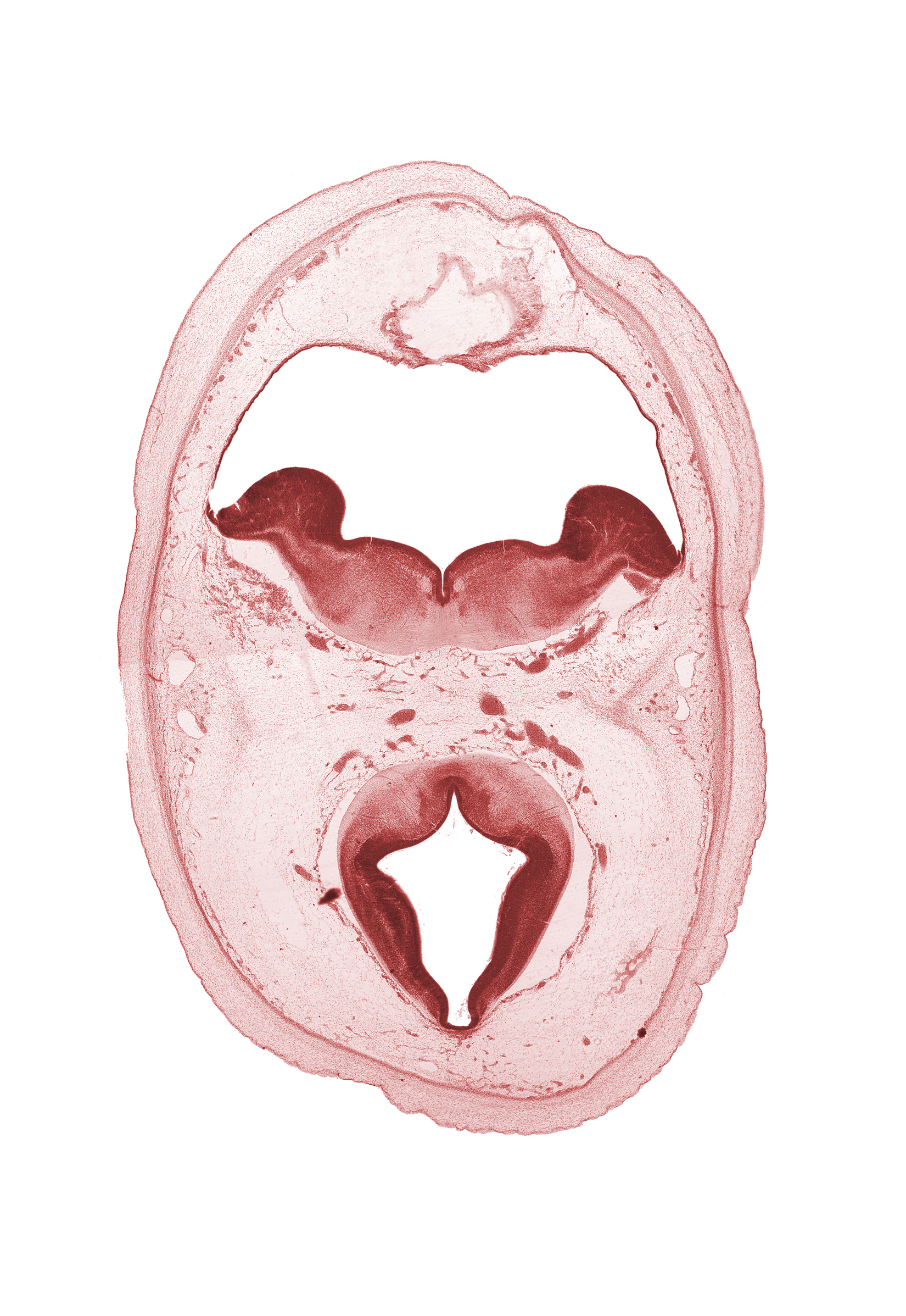 alar plate of metencephalon (cerebellum), artifact separation(s), basal plate, diverticulum of rhombencoel (fourth ventricle), dorsal thalamus, floor plate, hypothalamic sulcus, oculomotor nerve (CN III), osteogenic layer, posterior cerebral artery, roof of rhombencoel (fourth ventricle), roof plate, subarachnoid space, sulcus limitans, superior cerebellar artery, trochlear nerve (CN IV)