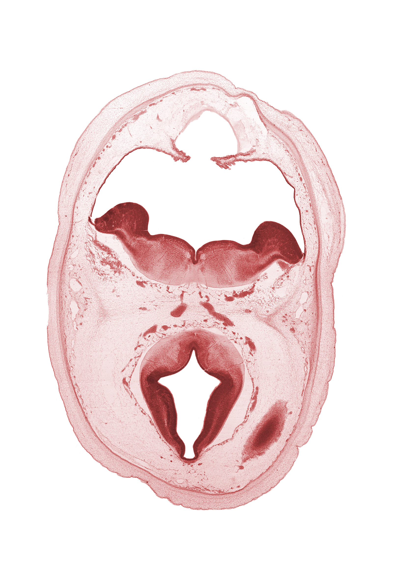 artifact separation(s), diverticulum of rhombencoel (fourth ventricle), dorsal thalamus, dural band for tentorium cerebelli, edge of cerebral vesicle(s), hypothalamic sulcus, hypothalamus, metencephalon, osteogenic layer, posterior cerebral artery, primordial transverse sinus, rhombencoel (fourth ventricle), subarachnoid space, sulcus dorsalis, sulcus limitans, surface ectoderm, third ventricle, venous plexus(es)