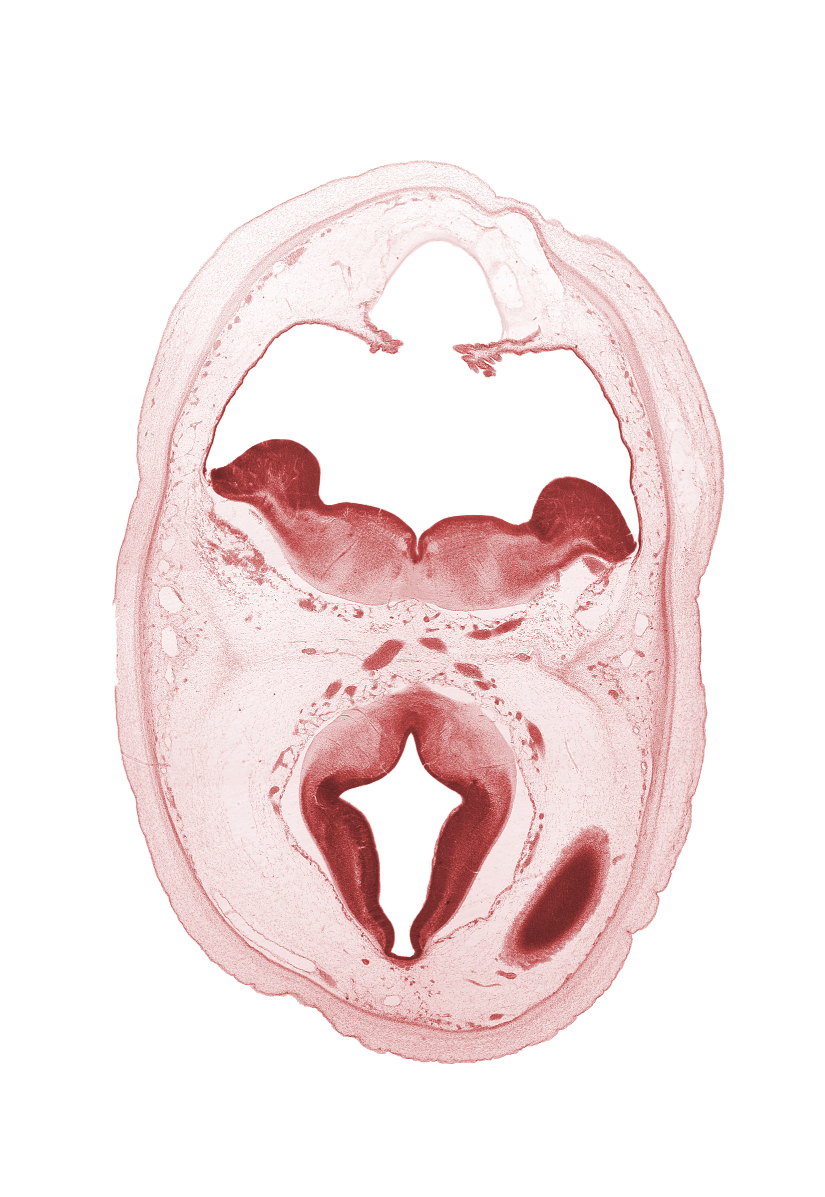 alar plate of metencephalon (cerebellum), artifact separation(s), basal plate, cephalic end of basilar artery, choroid fissure, diverticulum of rhombencoel (fourth ventricle), dorsal thalamus, hypothalamic sulcus, marginal zone of cerebral vesicle, median sulcus, oculomotor nerve (CN III), posterior communicating artery, rhombencoel (fourth ventricle), rhombic lip, roof plate, sulcus limitans, trochlear nerve (CN IV)